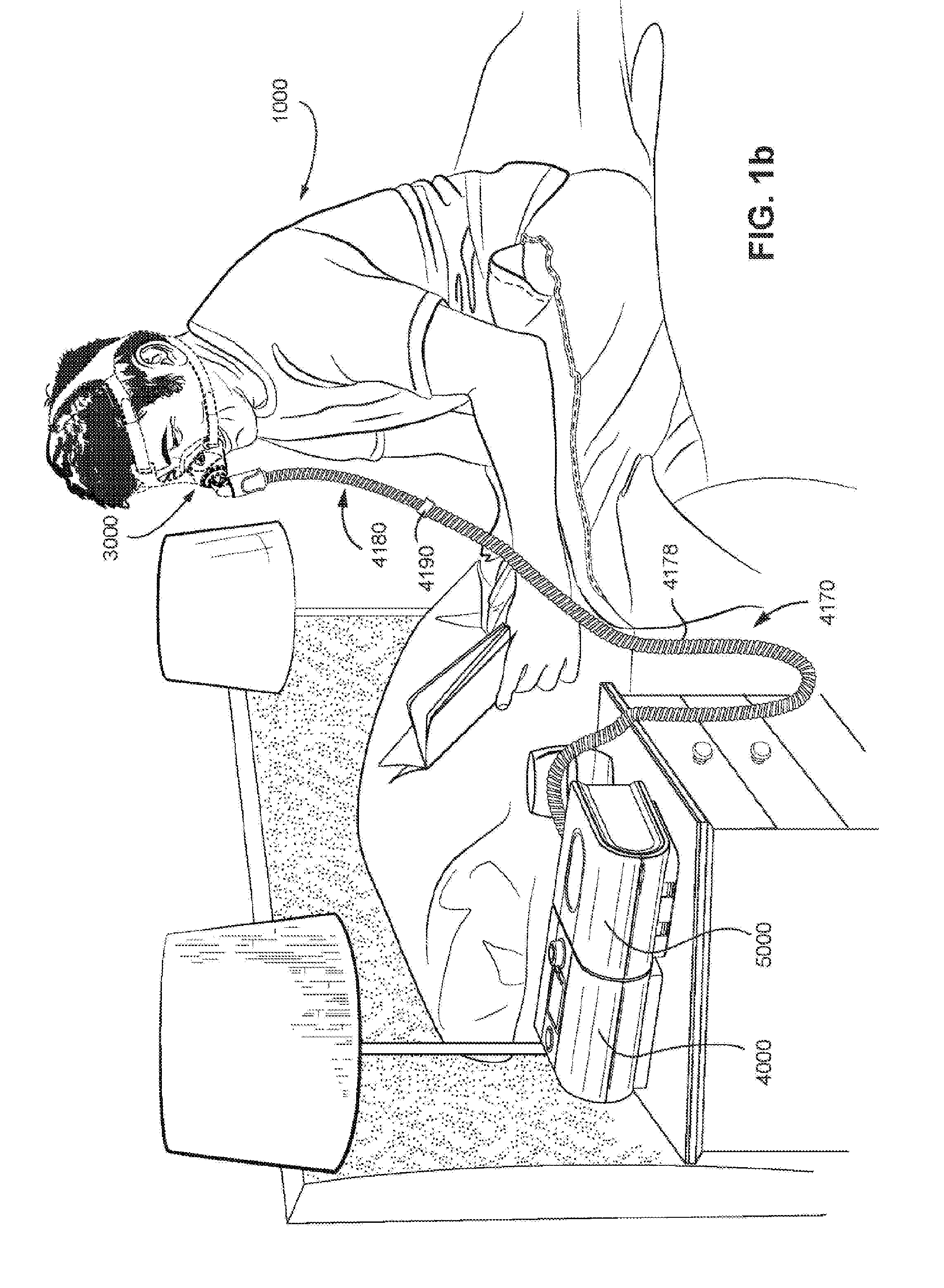 Patient interface and method for making same