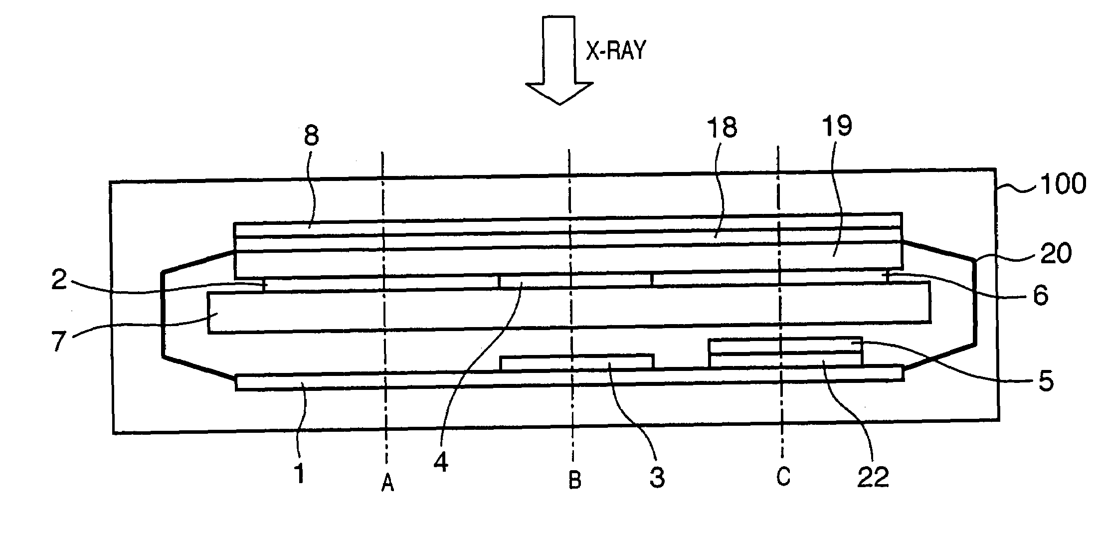 Radiographic apparatus