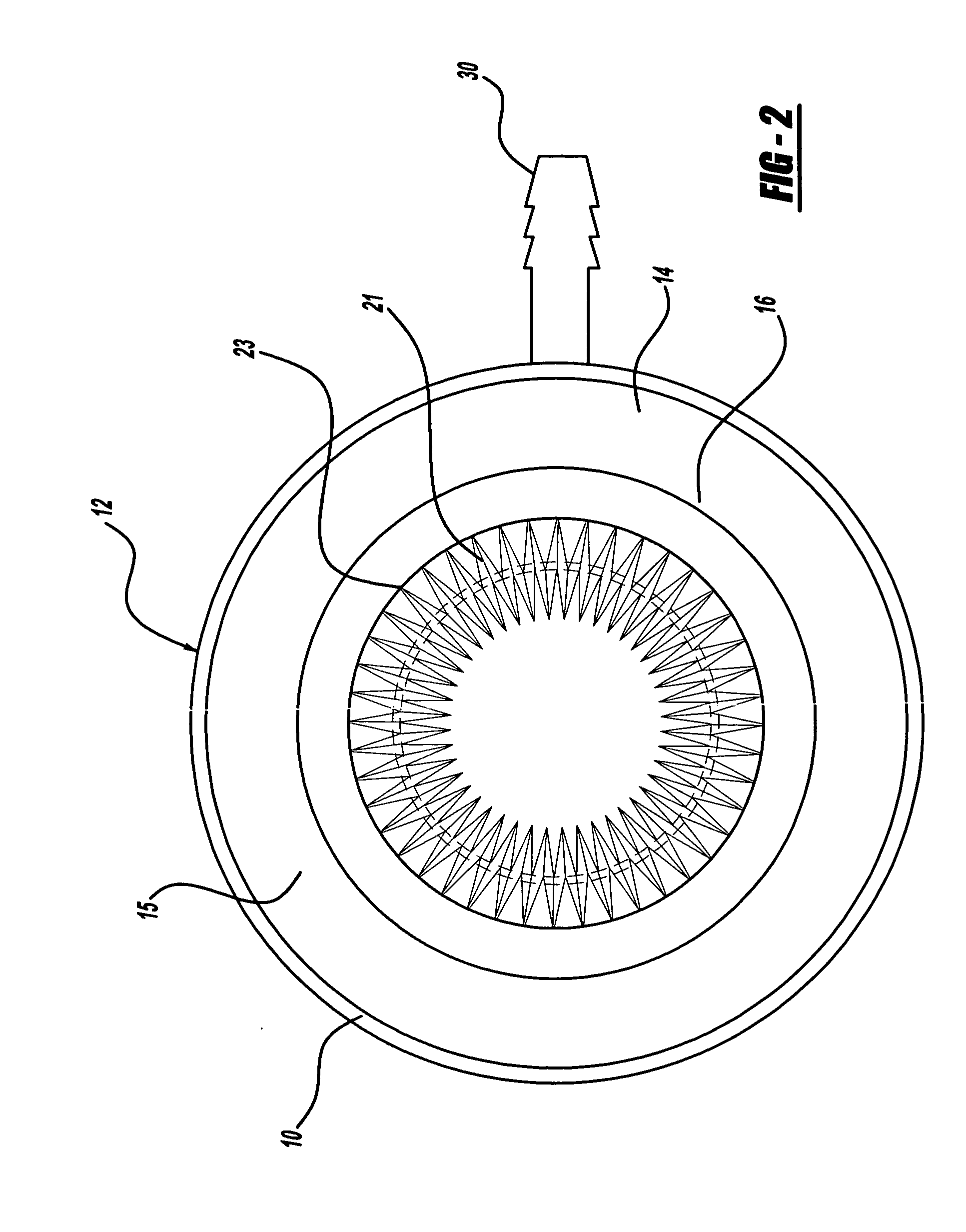 Fuel vent assembly with floatless rollover protection