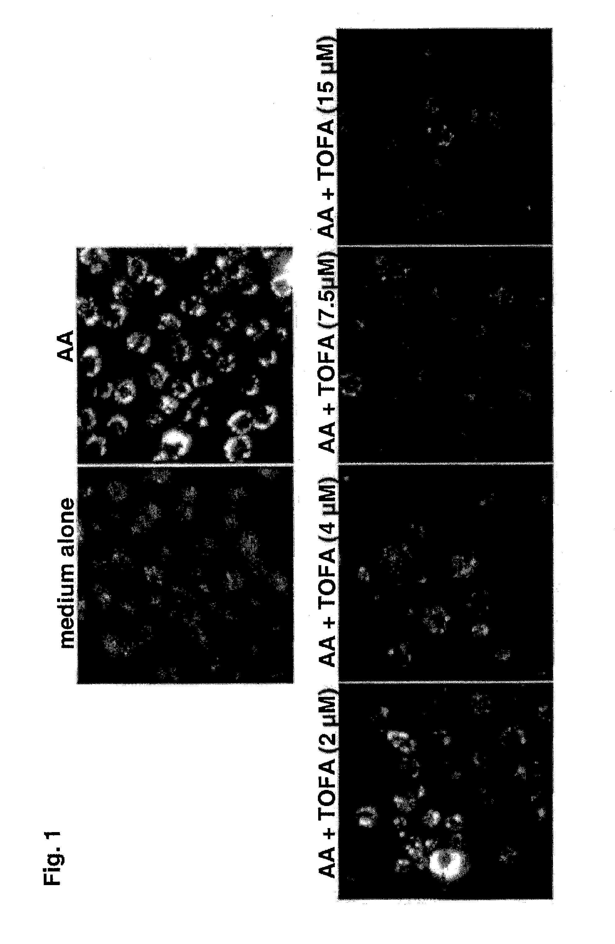 Methods of treating dermatological disorders or conditions