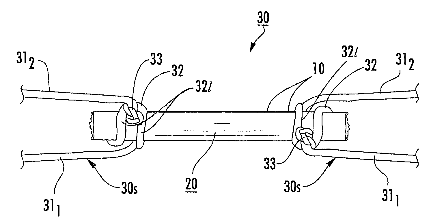 Tendon or ligament bioprostheses and methods of making same