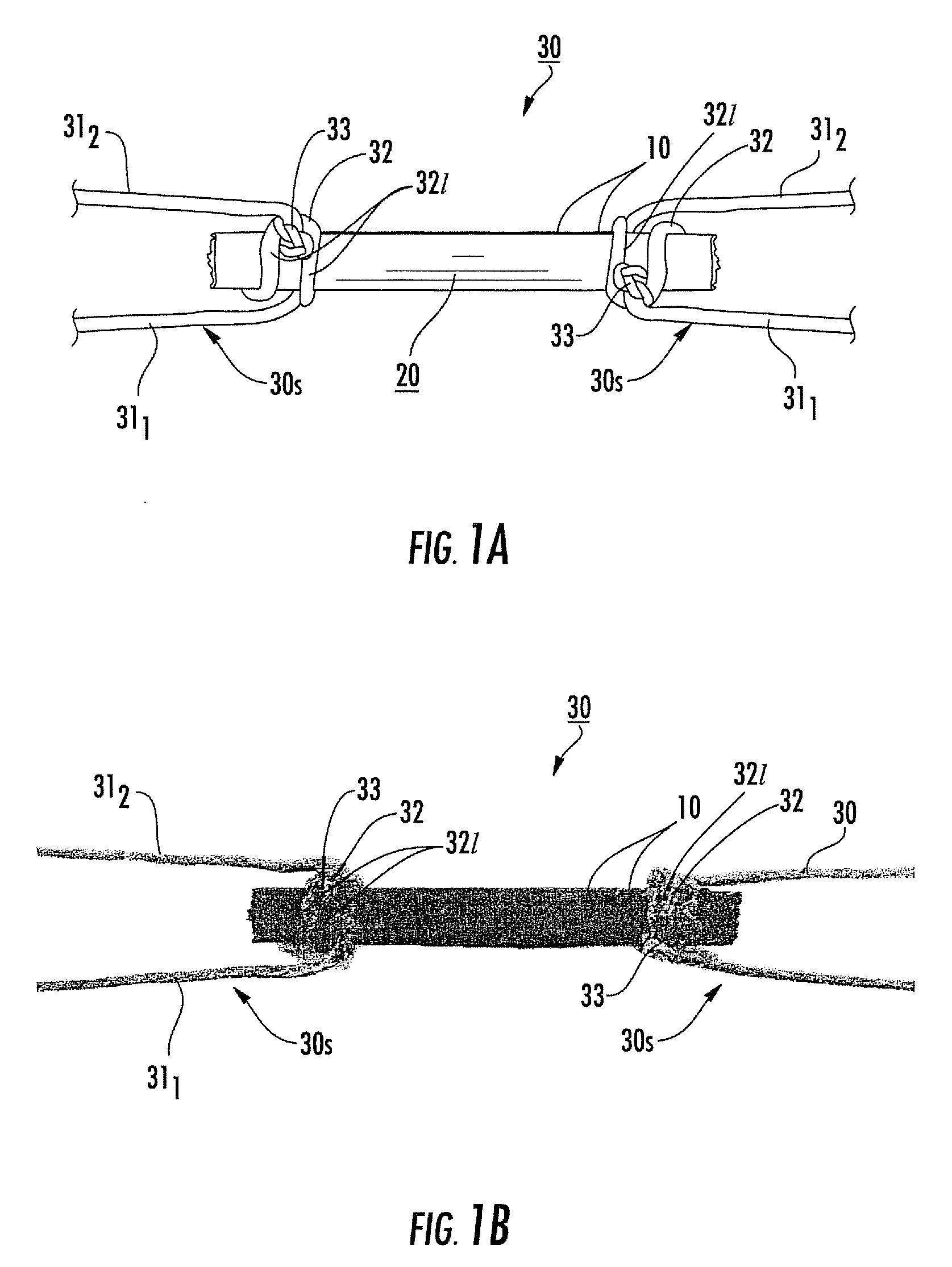 Tendon or ligament bioprostheses and methods of making same