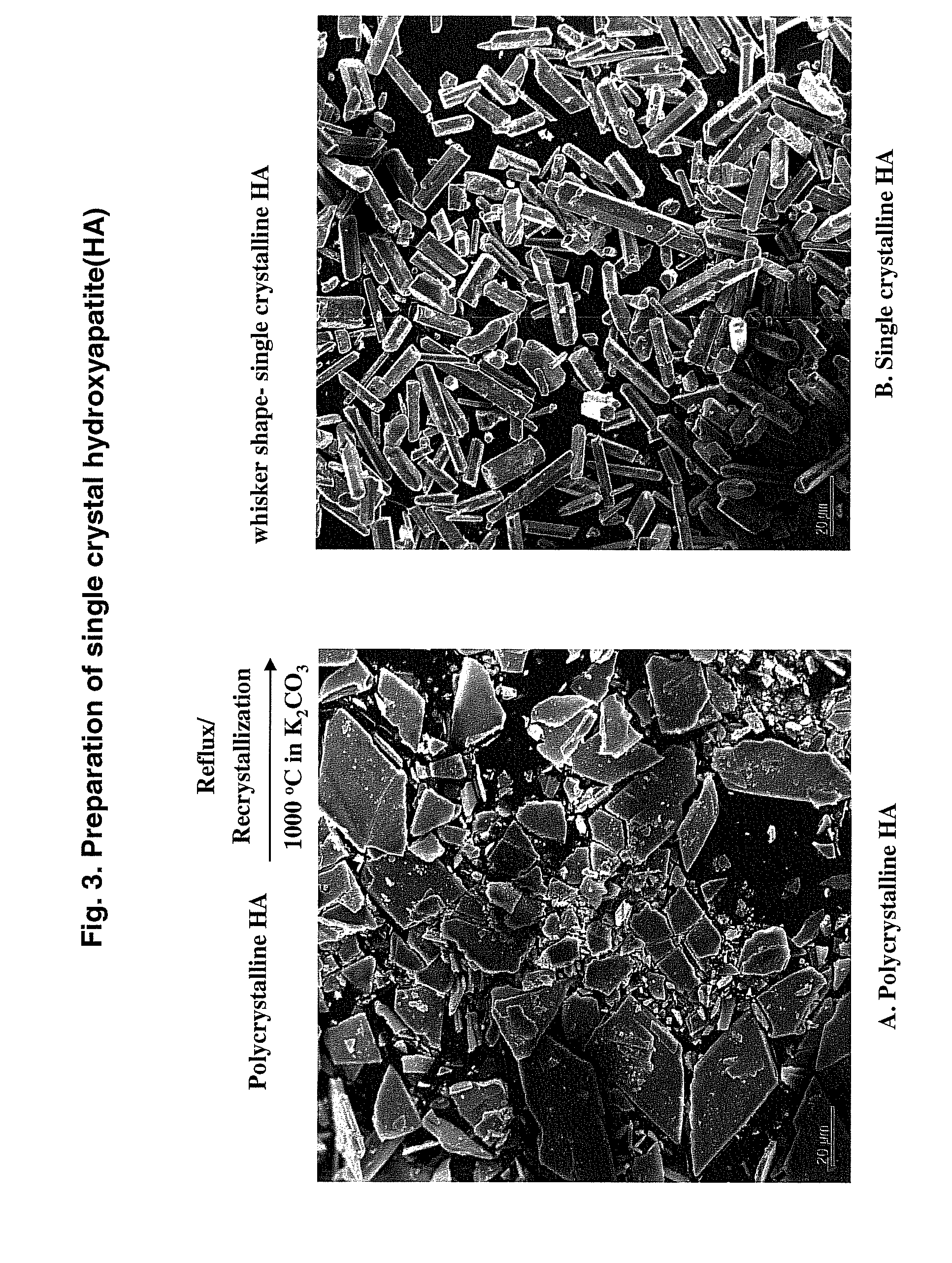 Hydroxyapatite-binding peptides for bone growth and inhibition