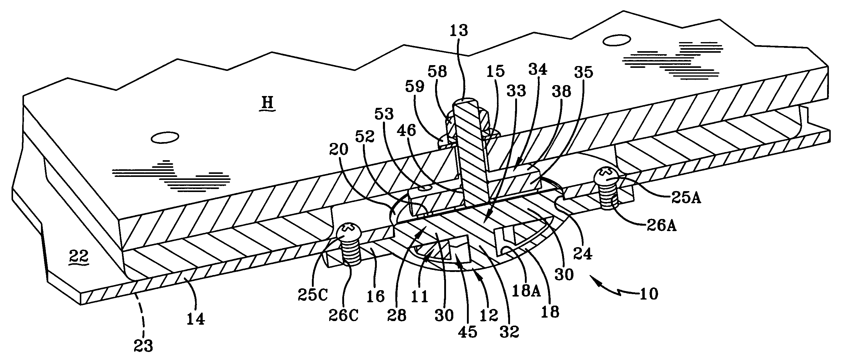 Anchoring system