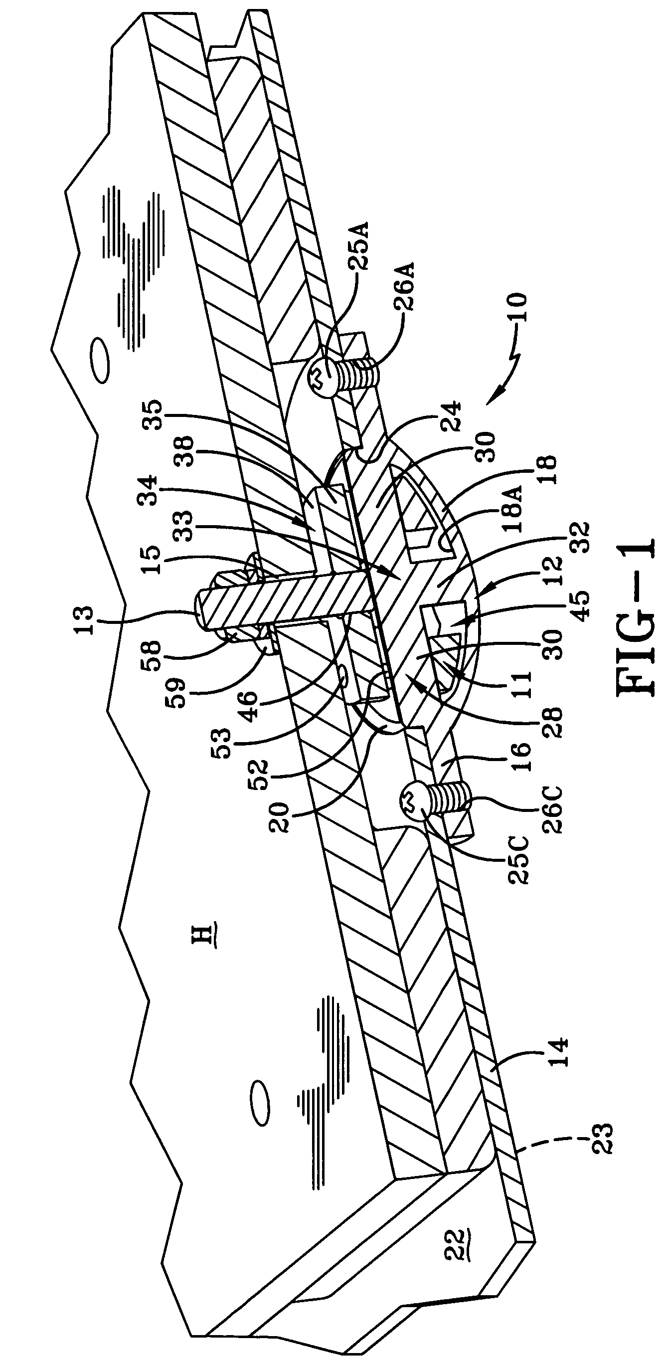 Anchoring system