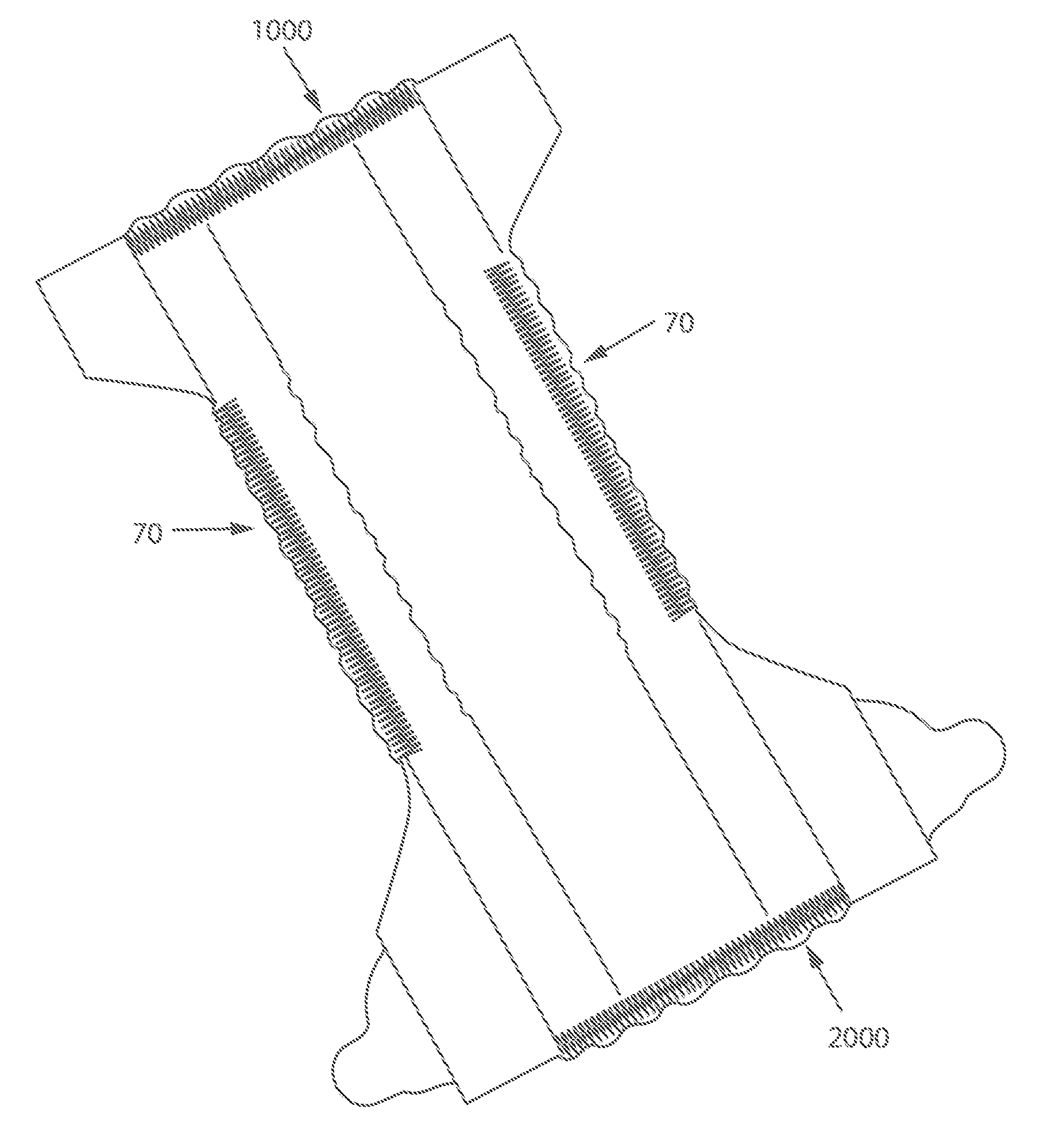 Absorbent Article With A Waistband And Leg Cuff Having Gathers