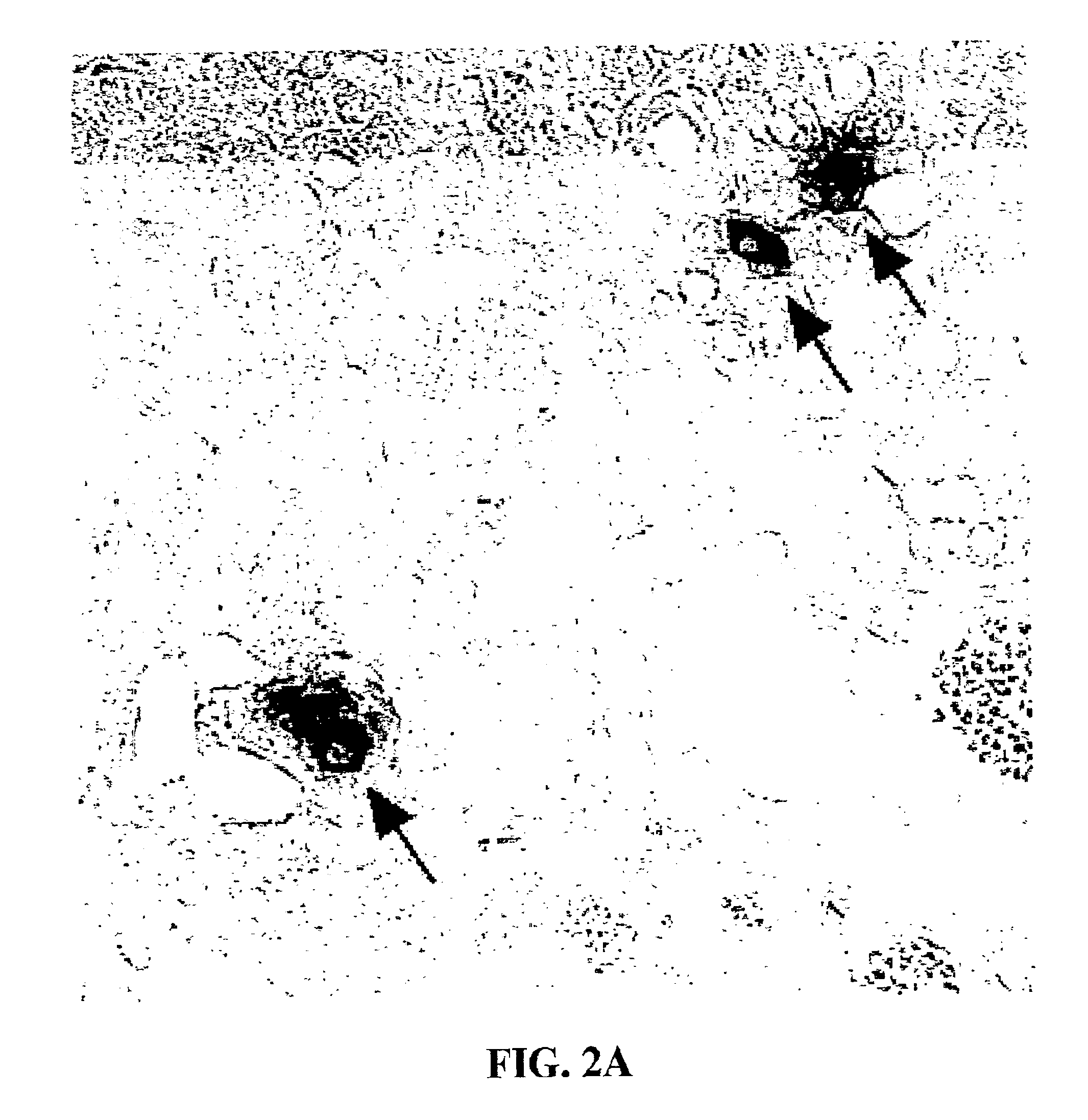 Production of pancreatic islet cells and delivery of insulin