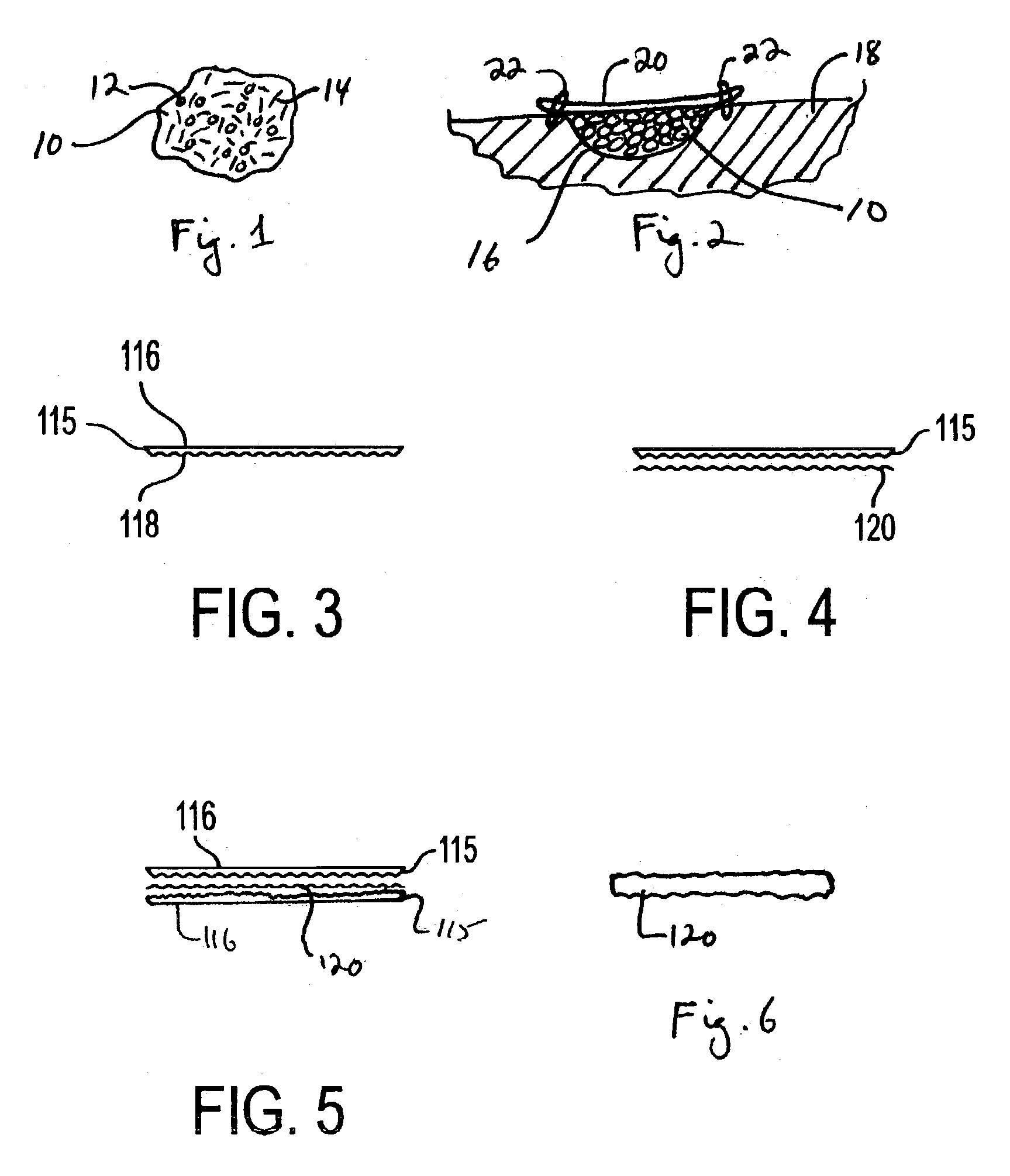 Resorbable extracellular matrix for reconstruction of bone