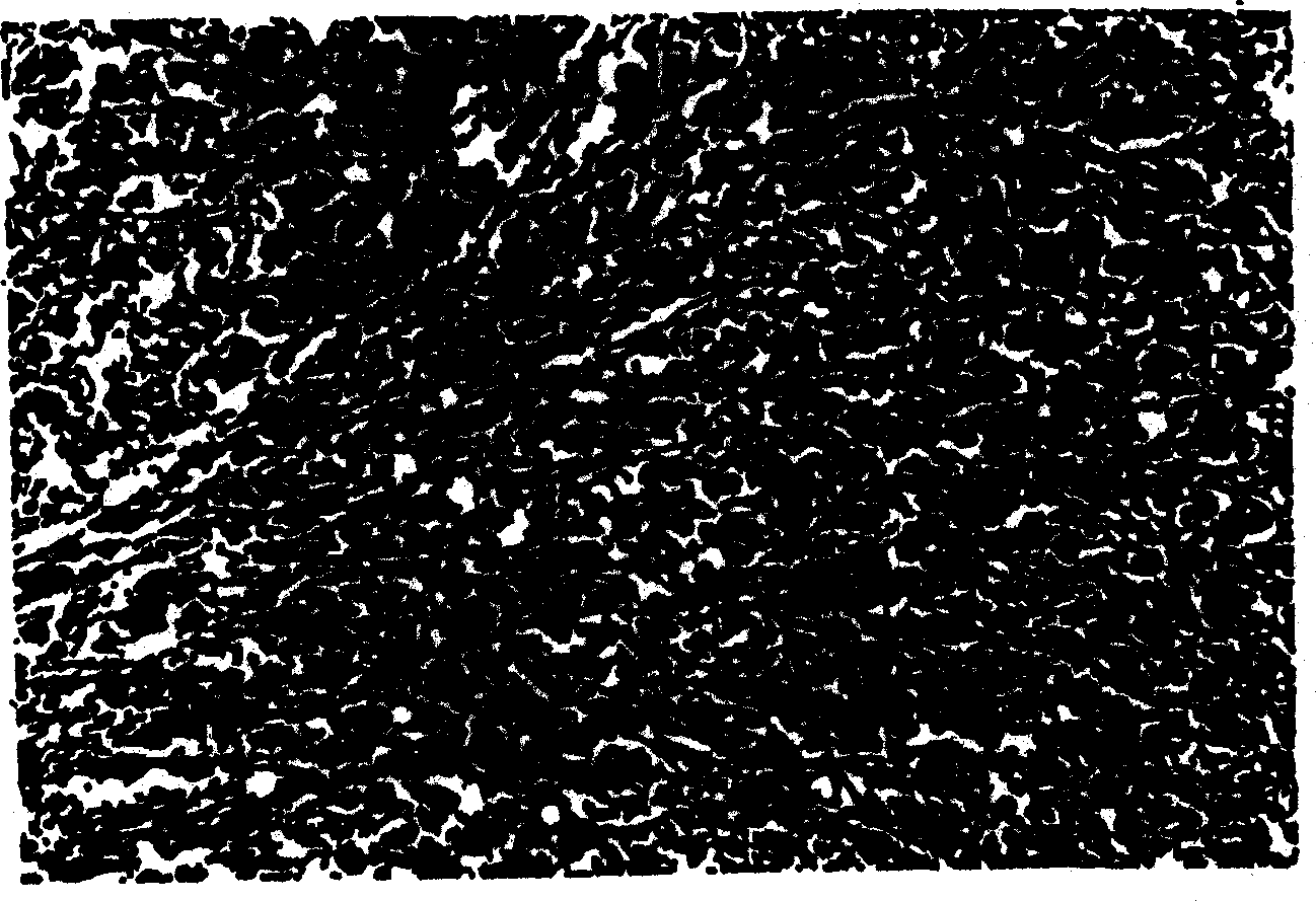 Tissue augmentation material and methods