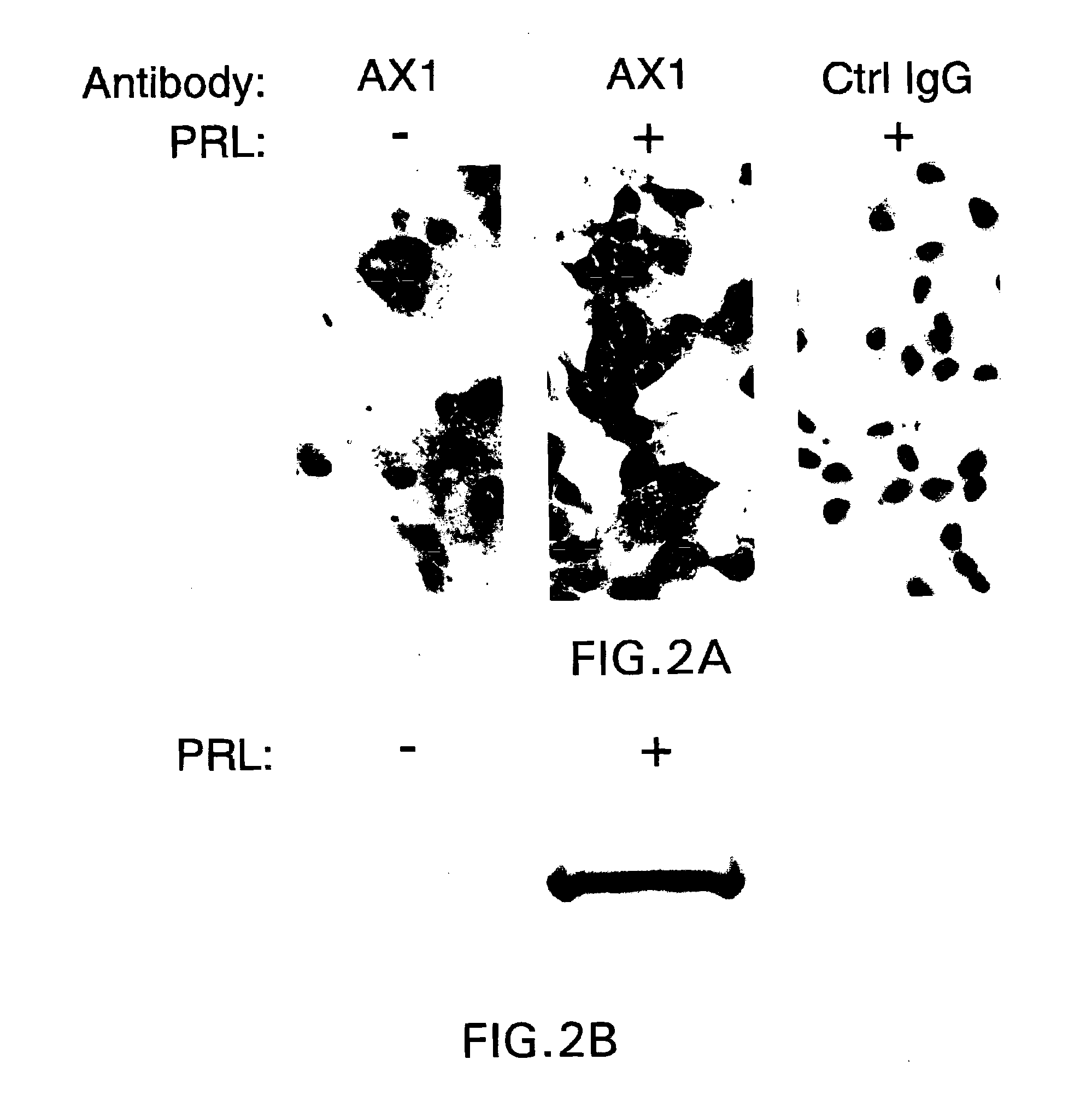 Method for predicting responsiveness of breast cancer to antiestrogen therapy