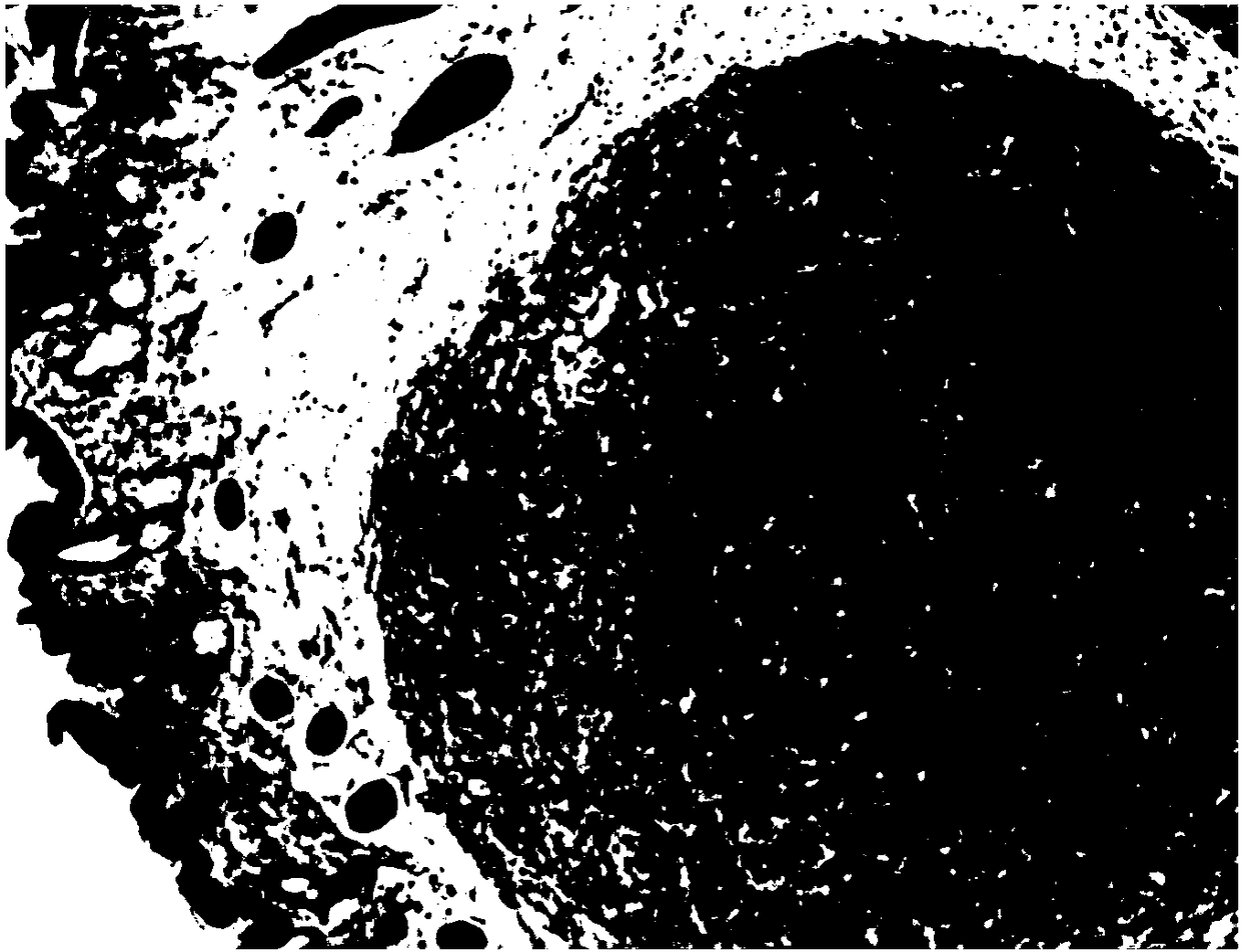 Spray photosensitizer composition for photodynamic therapy to treat diseases of nasal and laryngopharyngeal cavities