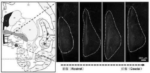 Construction method of gene overexpression chimeric animal model based on hNPY and application of construction method