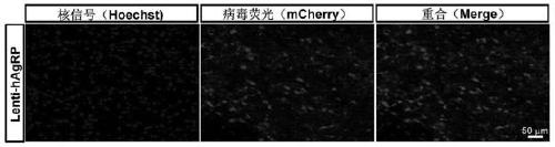 Construction method of gene overexpression chimeric animal model based on hNPY and application of construction method