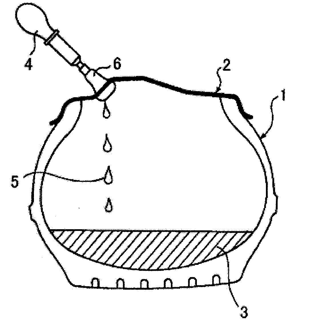 Puncture Repair Material Recovery System