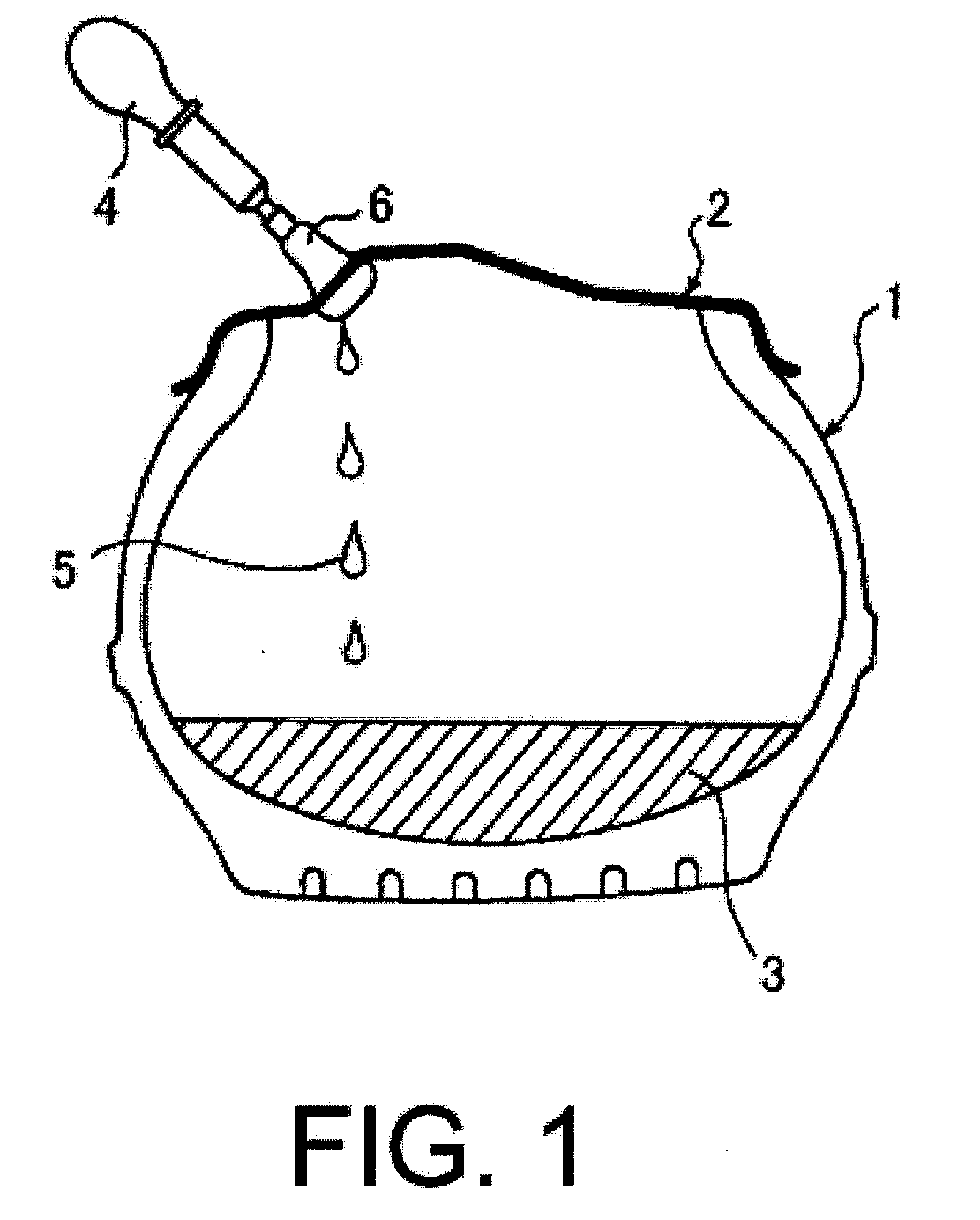 Puncture Repair Material Recovery System