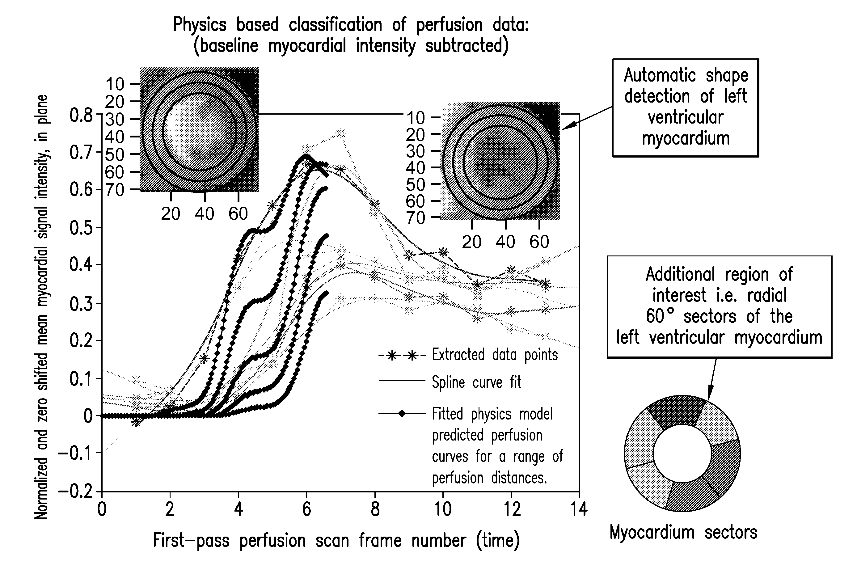 Physics based image processing and evaluation process of perfusion images from radiology imaging