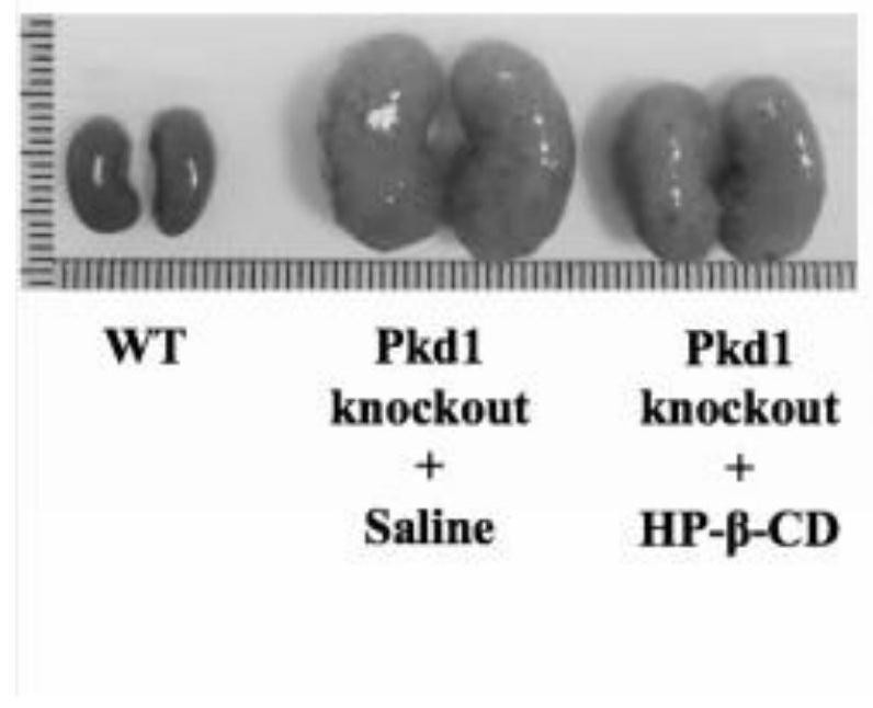 Application of cyclodextrin in preparation of medicine for treating and/or preventing polycystic kidney disease