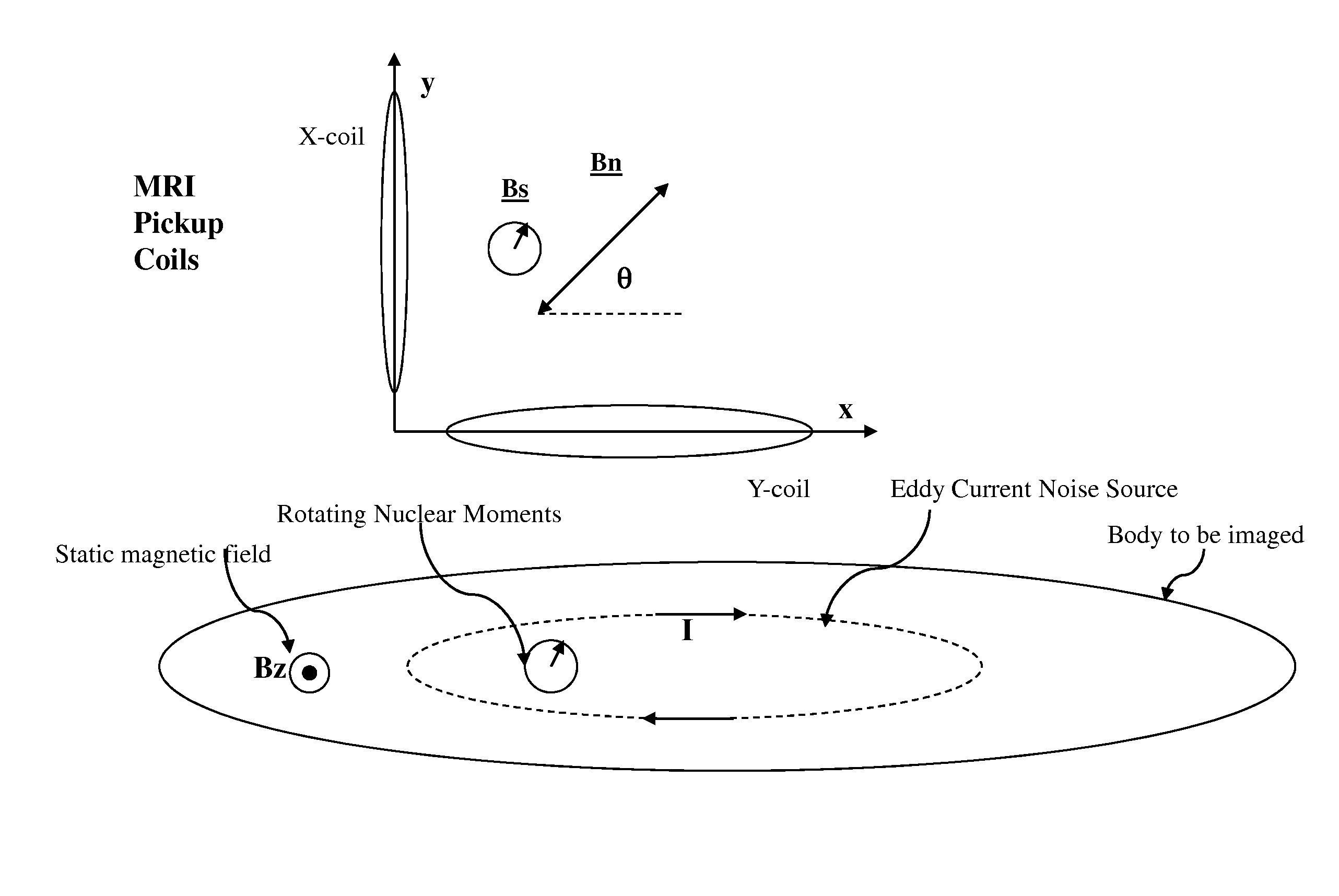 System and method for noise reduction in magnetic resonance imaging