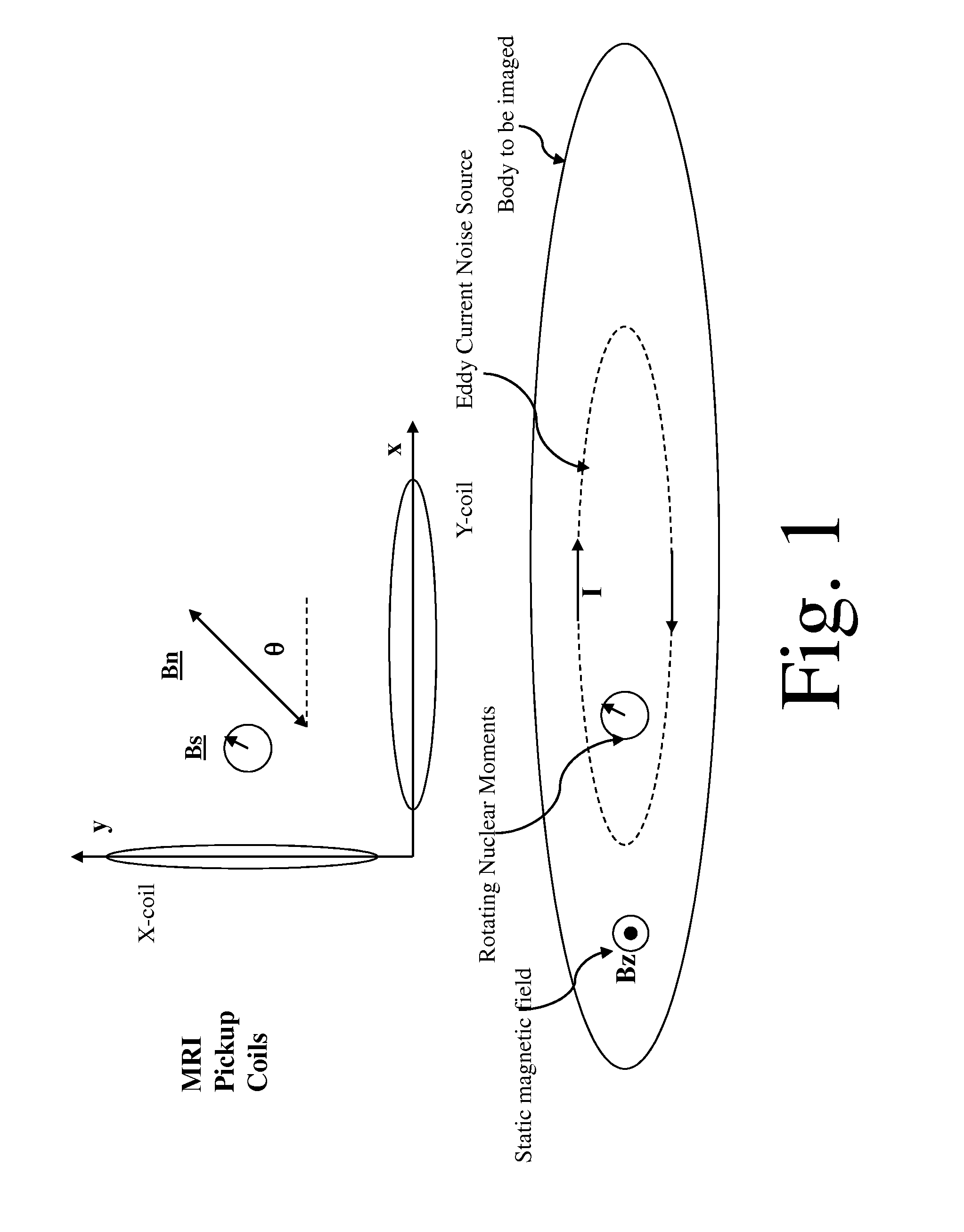 System and method for noise reduction in magnetic resonance imaging