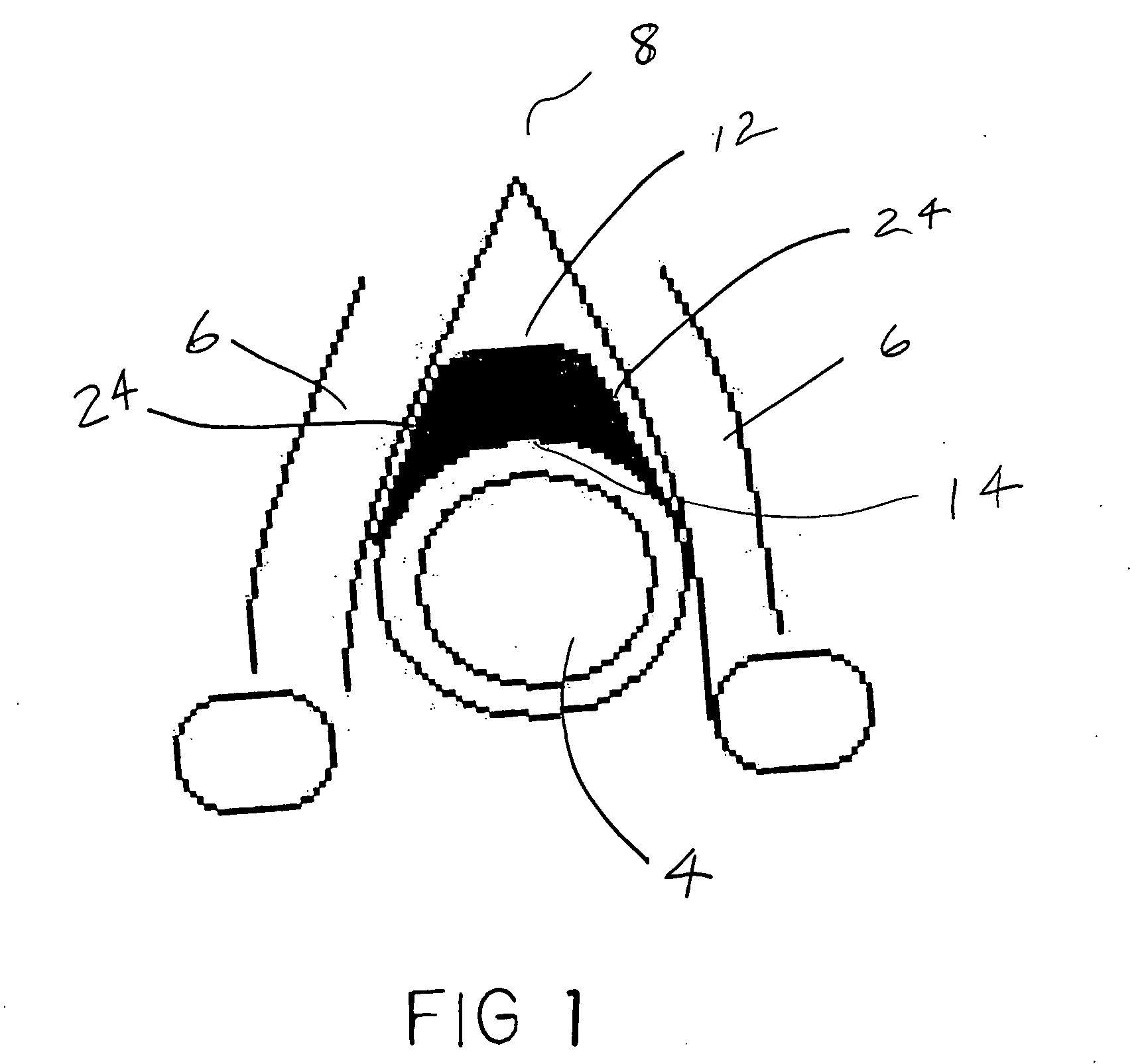 Endotracheal positioning device