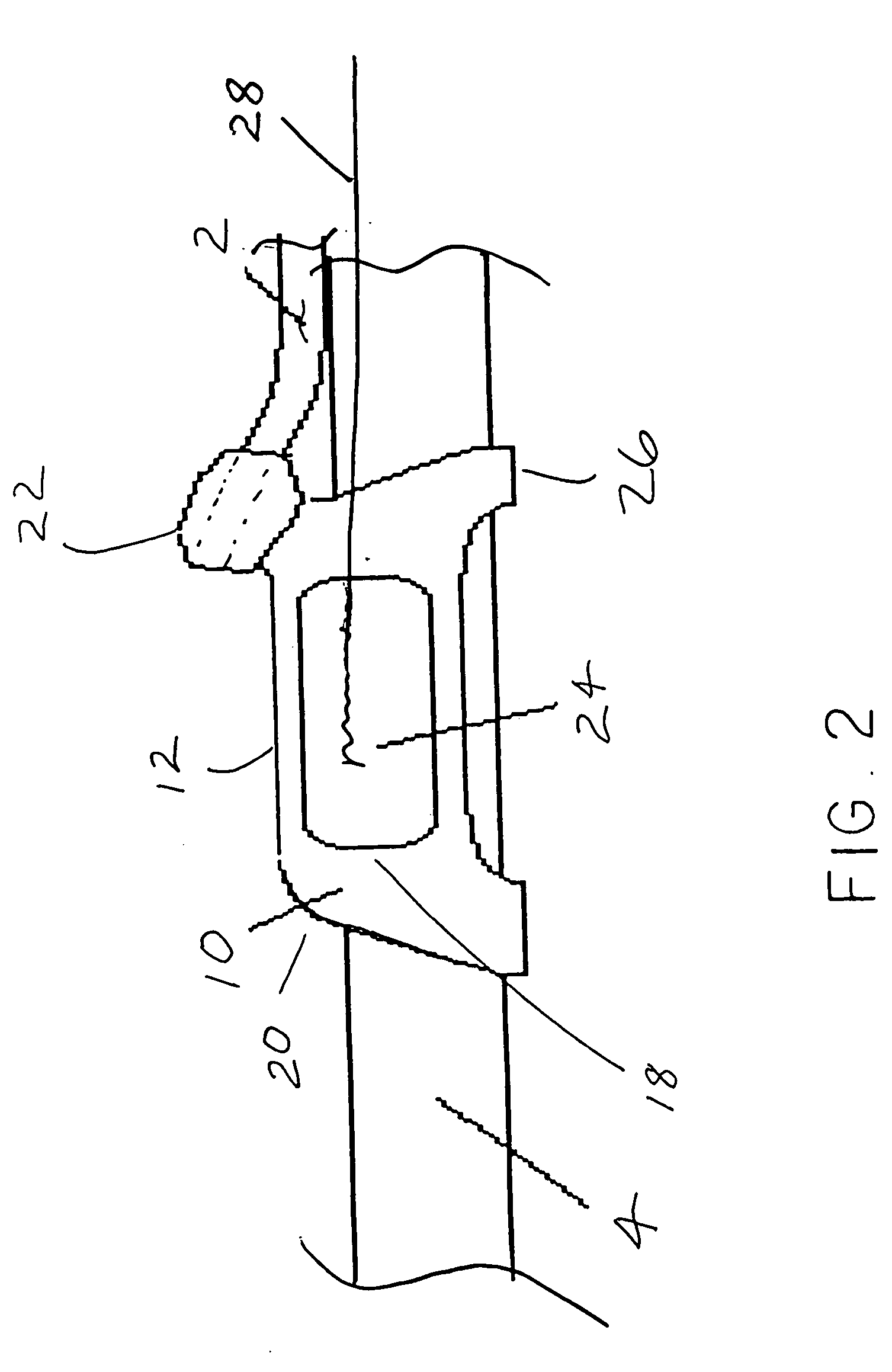 Endotracheal positioning device