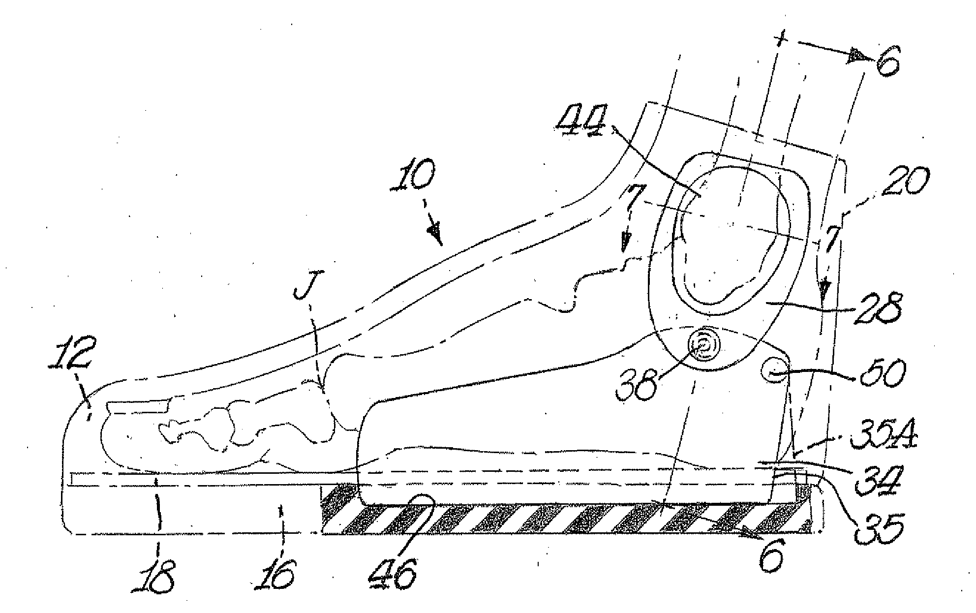 Ankle sprain reduction system