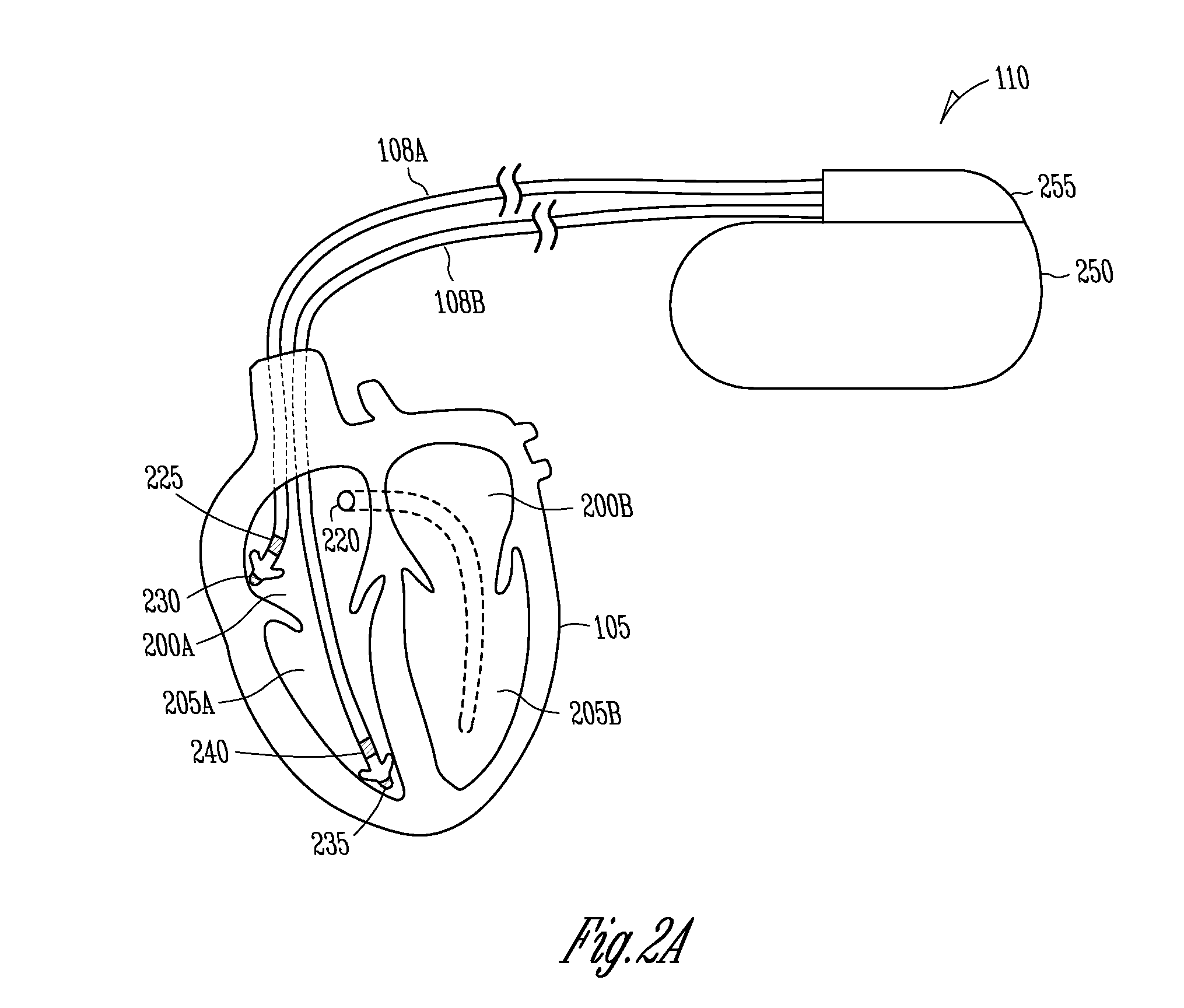 Intracardiac impedance and its applications