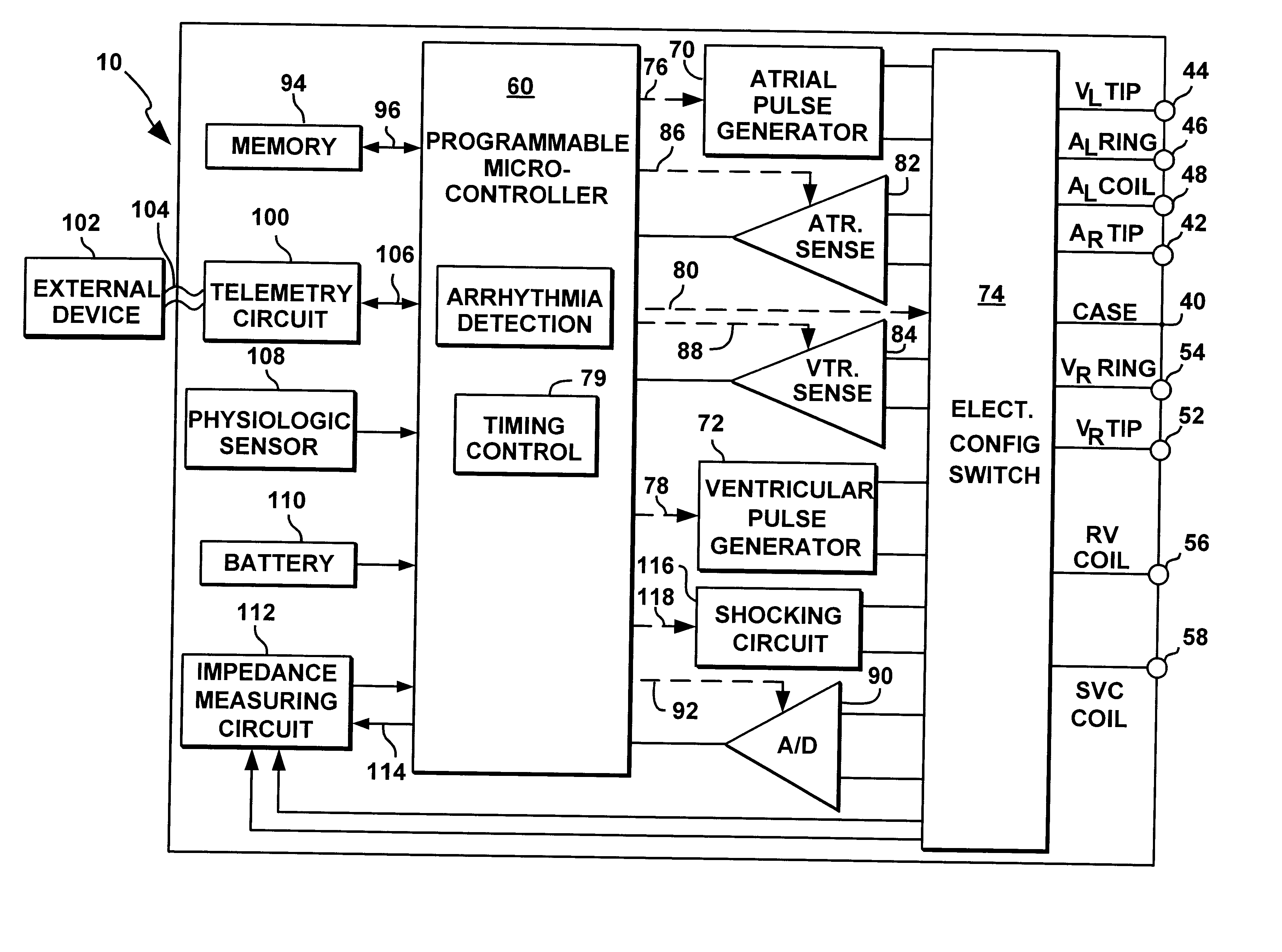 System and method for automatically selecting electrode polarity during sensing and stimulation