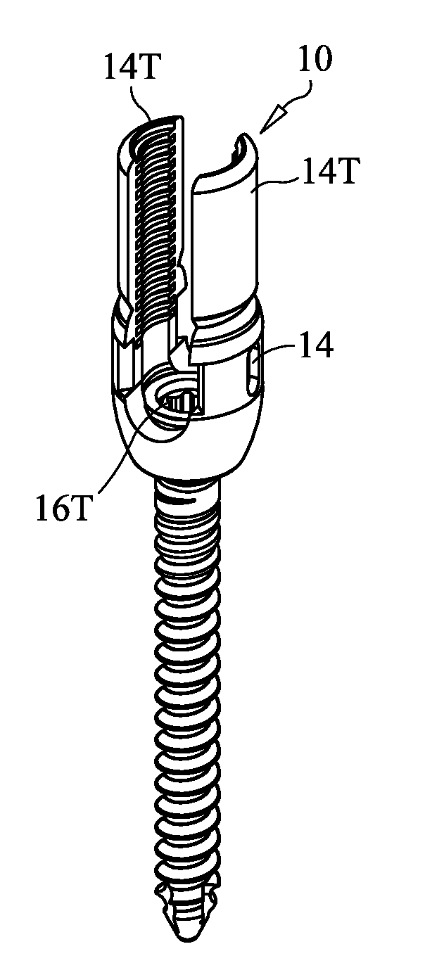 Locking Force Augmentation Features for Surgical Screw Assembly