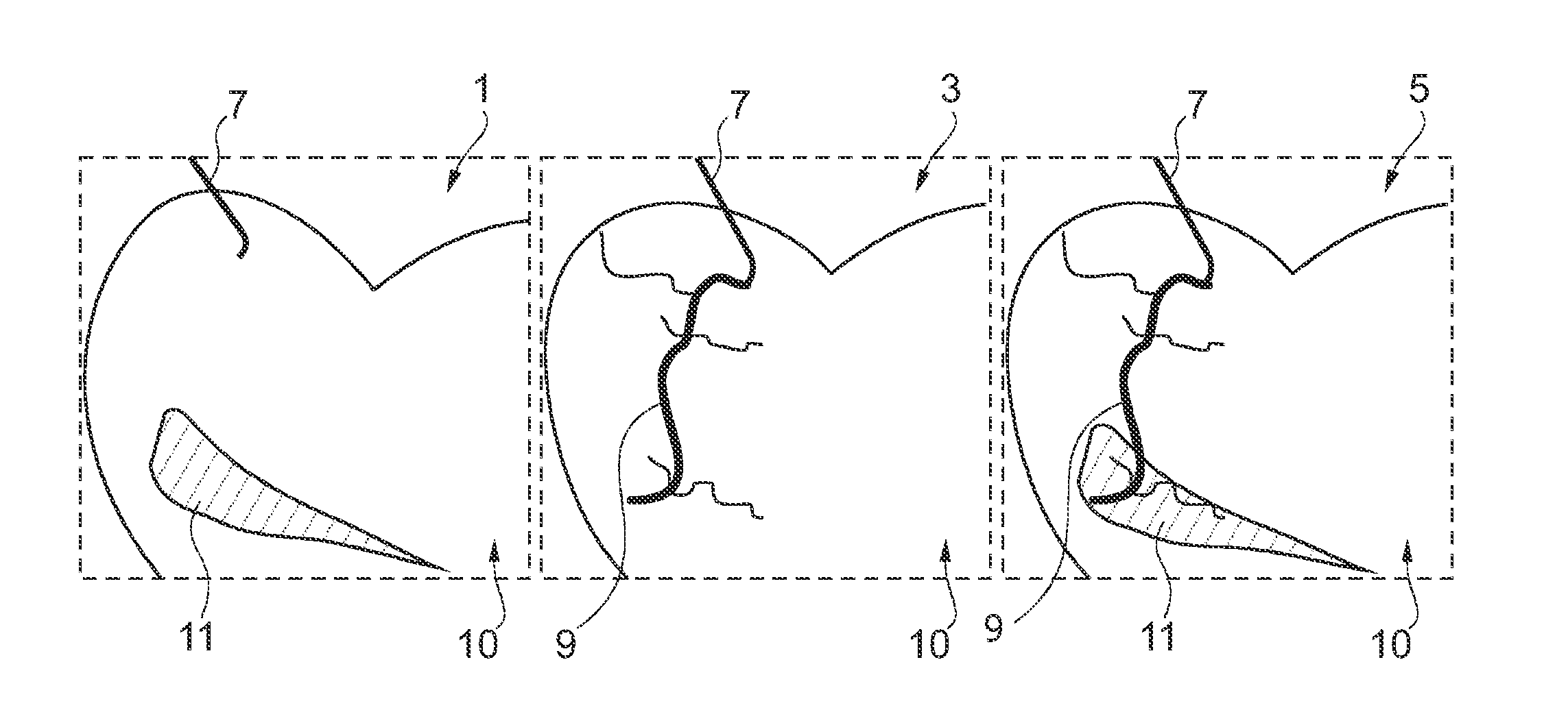 Dynamical visualization of coronary vessels and myocardial perfusion information