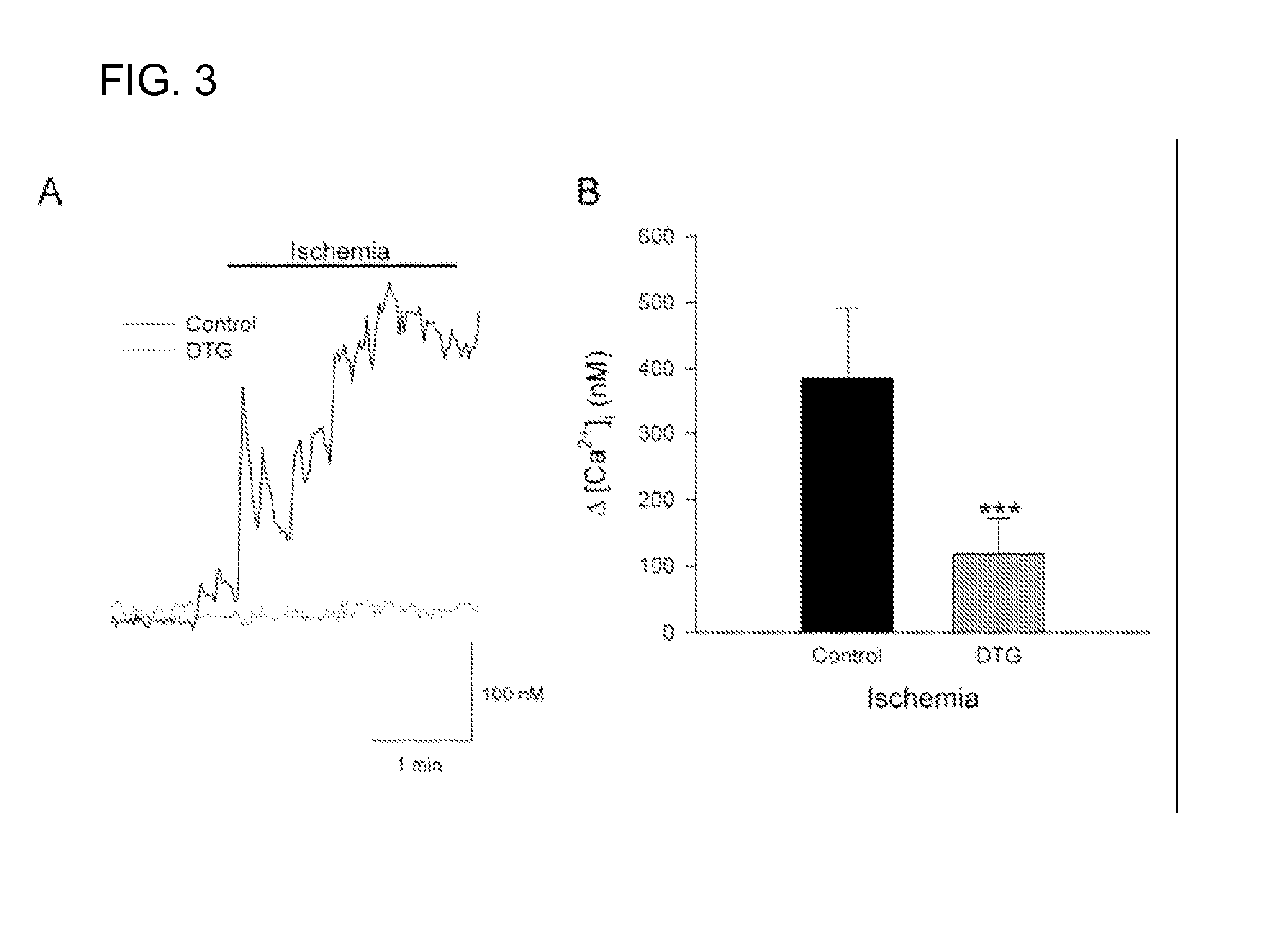 Treatment with Sigma Receptor Agonists Post-Stroke