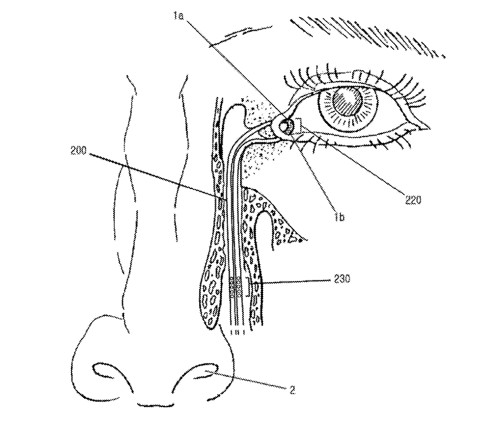 Nasolacrimal duct tube including lachrymal passage