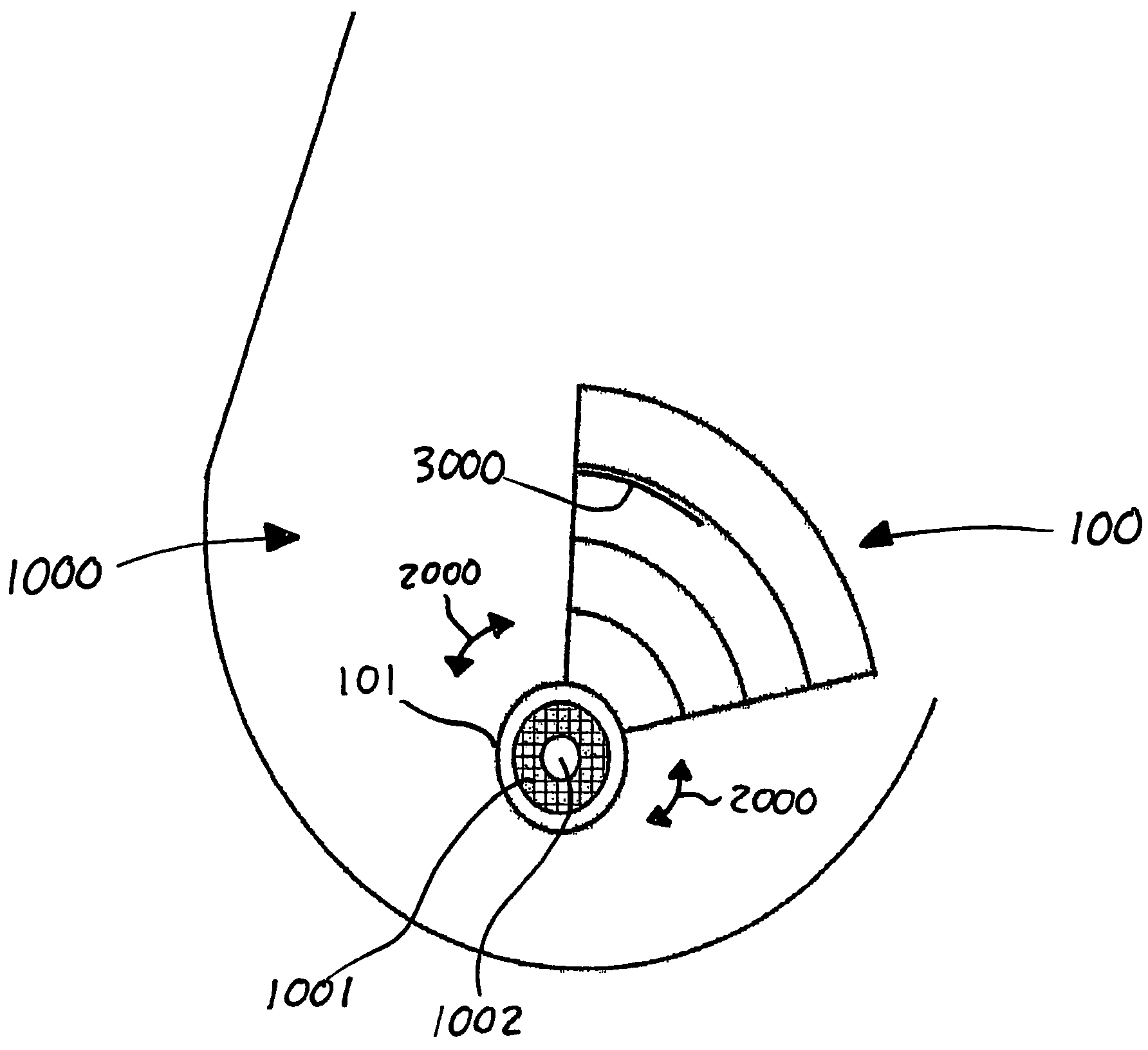 Apparatus and method for optimizing a surgical incision on the breast