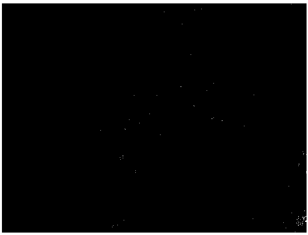 Concentrated adipose-derived stem cell culture supernatant preparation and preparation method and application thereof