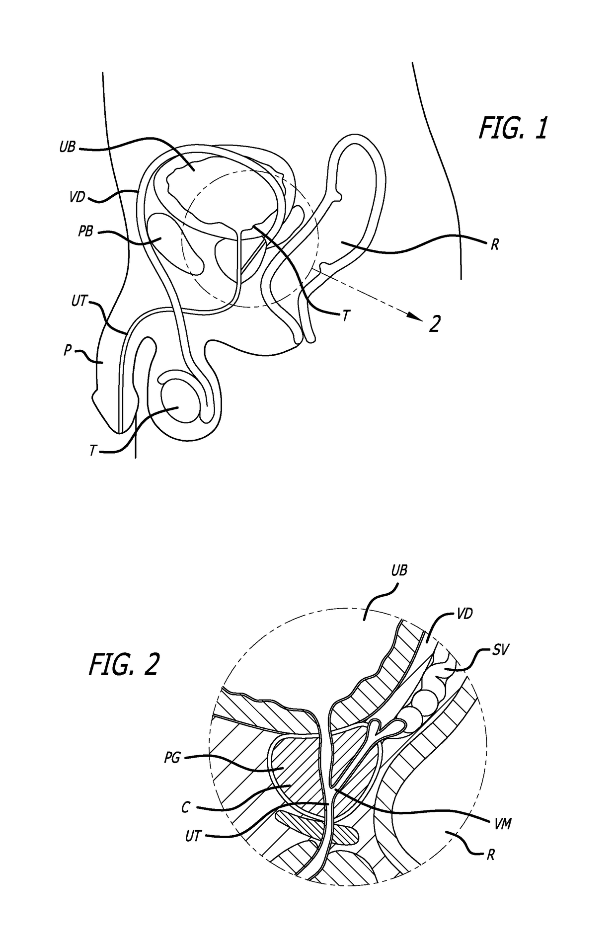 Flexible system for delivering an anchor