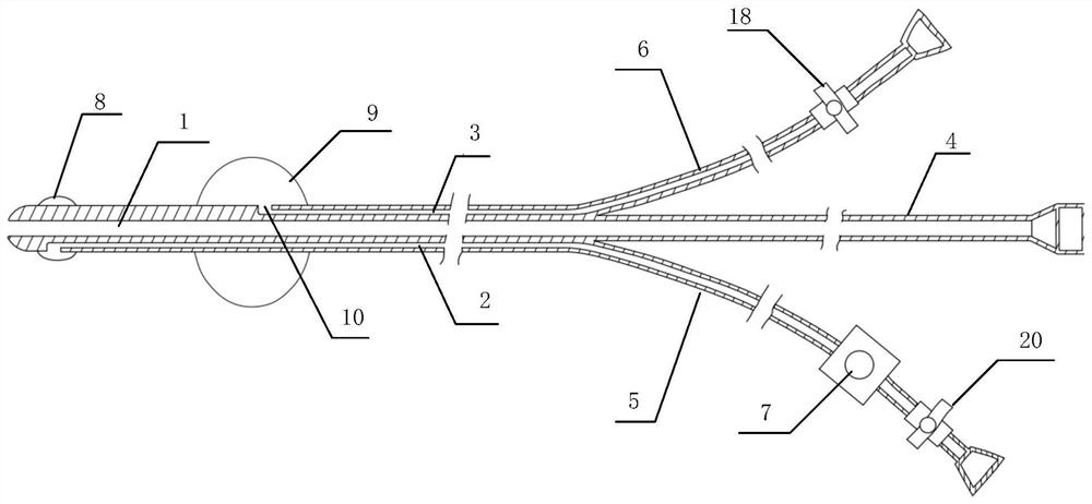 Indwelling pressure measuring and urethral catheterization device, bladder monitor applying device and application method