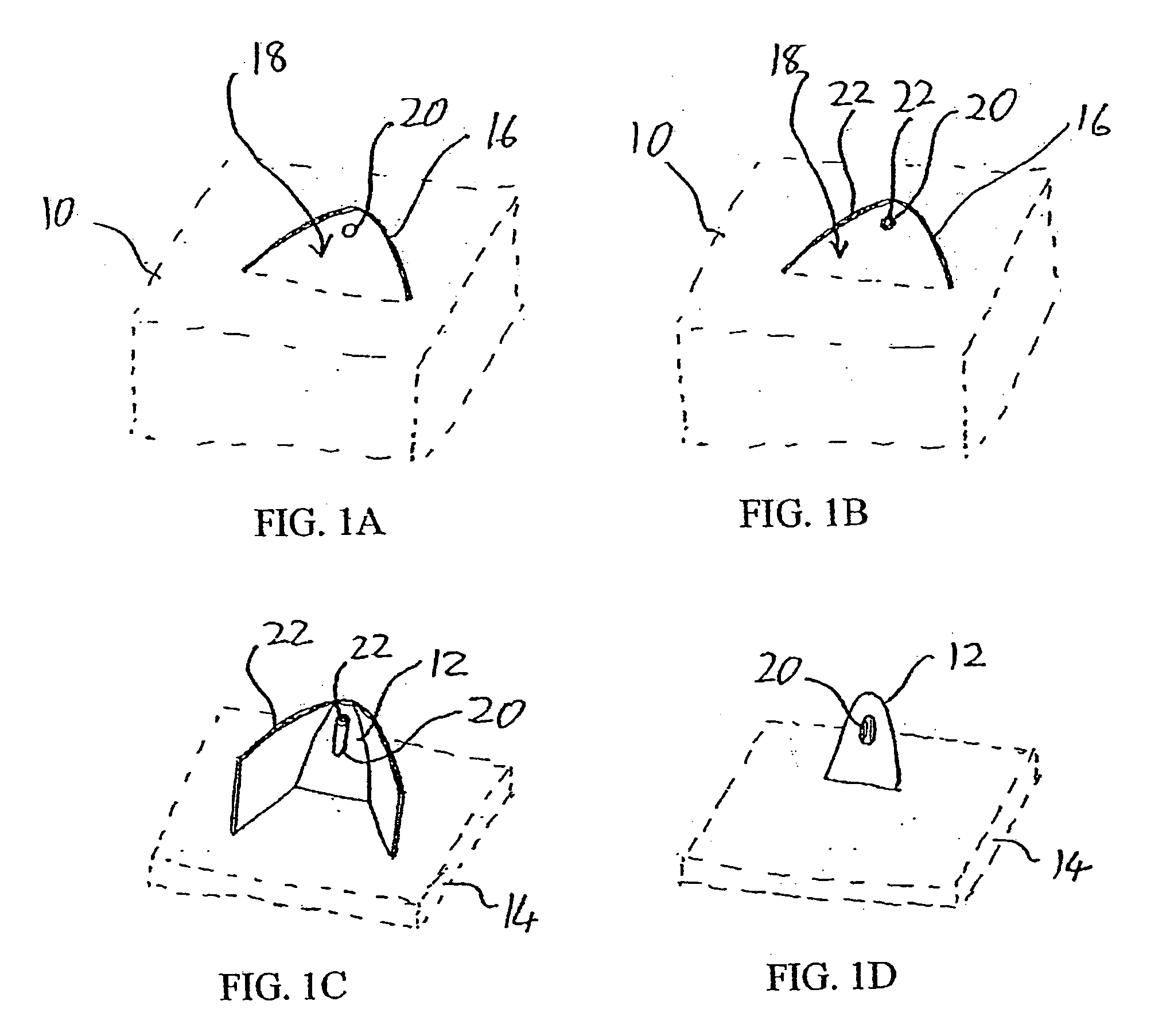 Microneedle structure and production method therefor