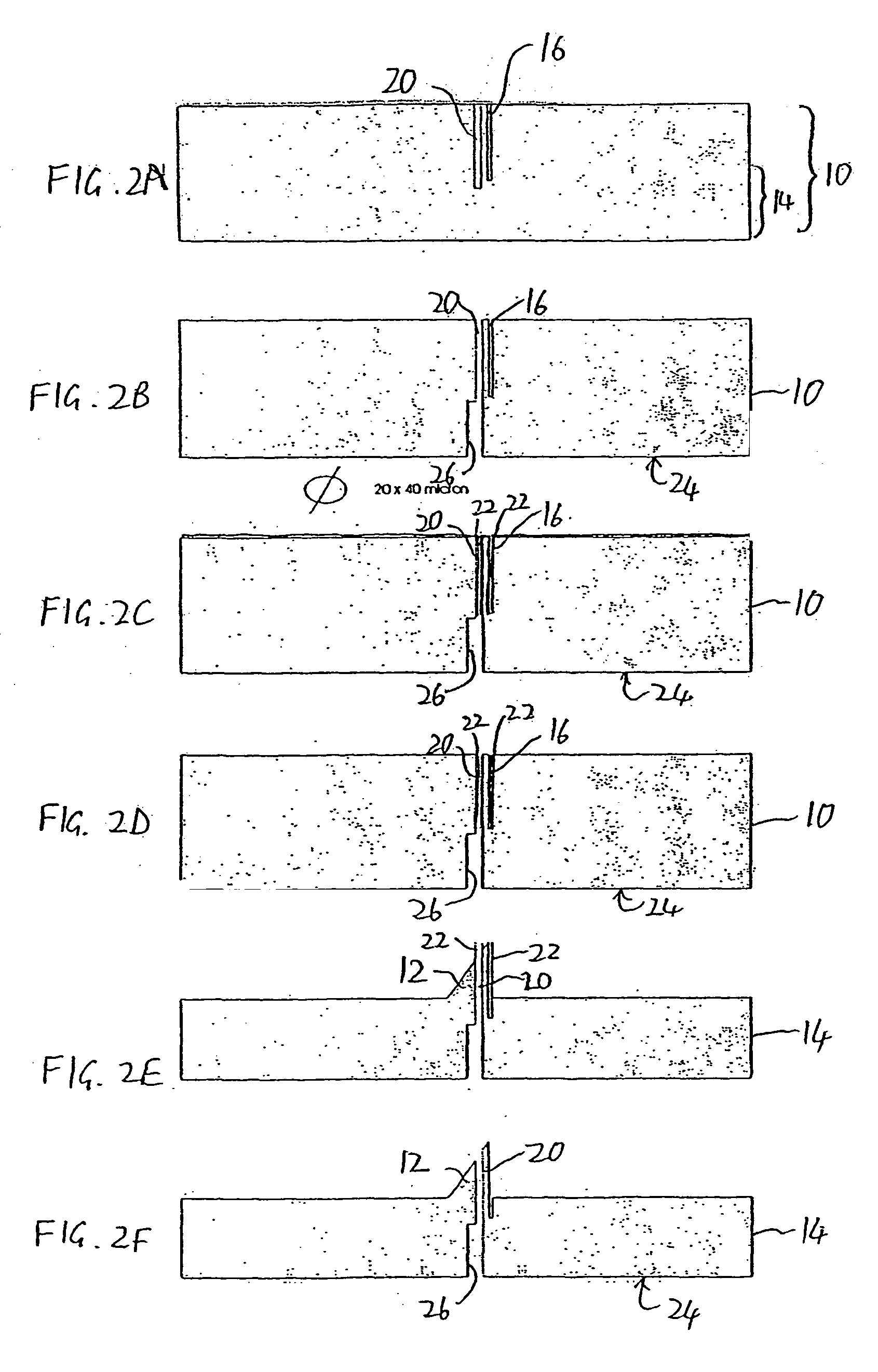 Microneedle structure and production method therefor