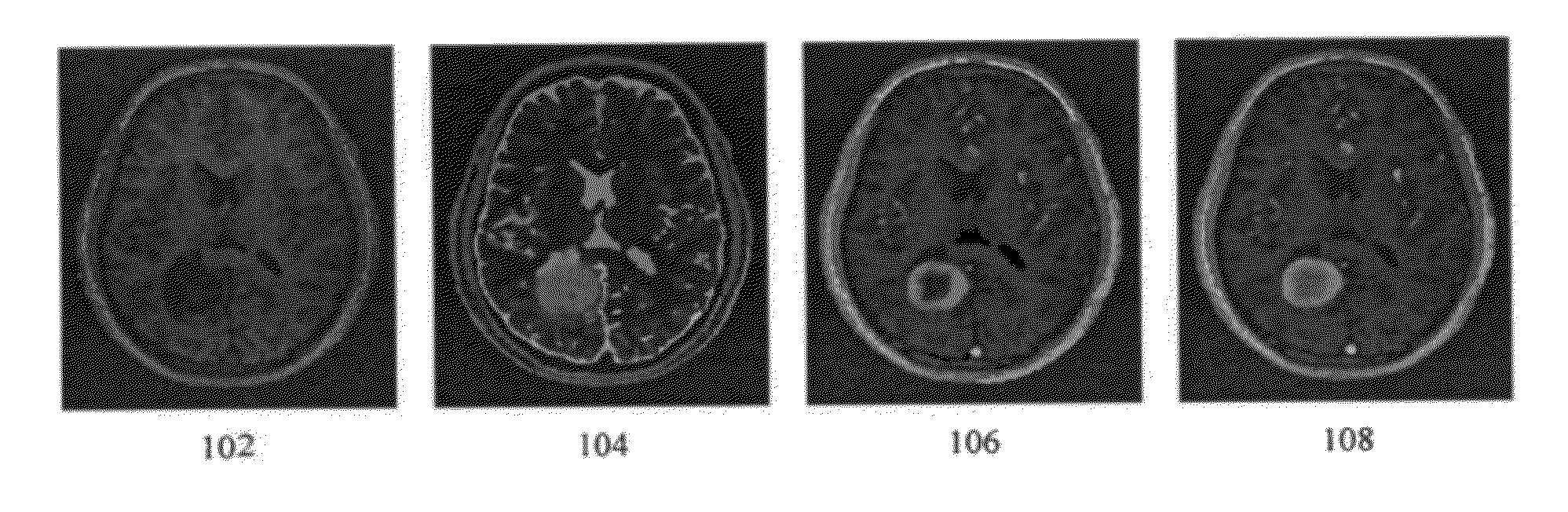 Method and system for brain tumor segmentation in multi-parameter 3D mr images via robust statistic information propagation