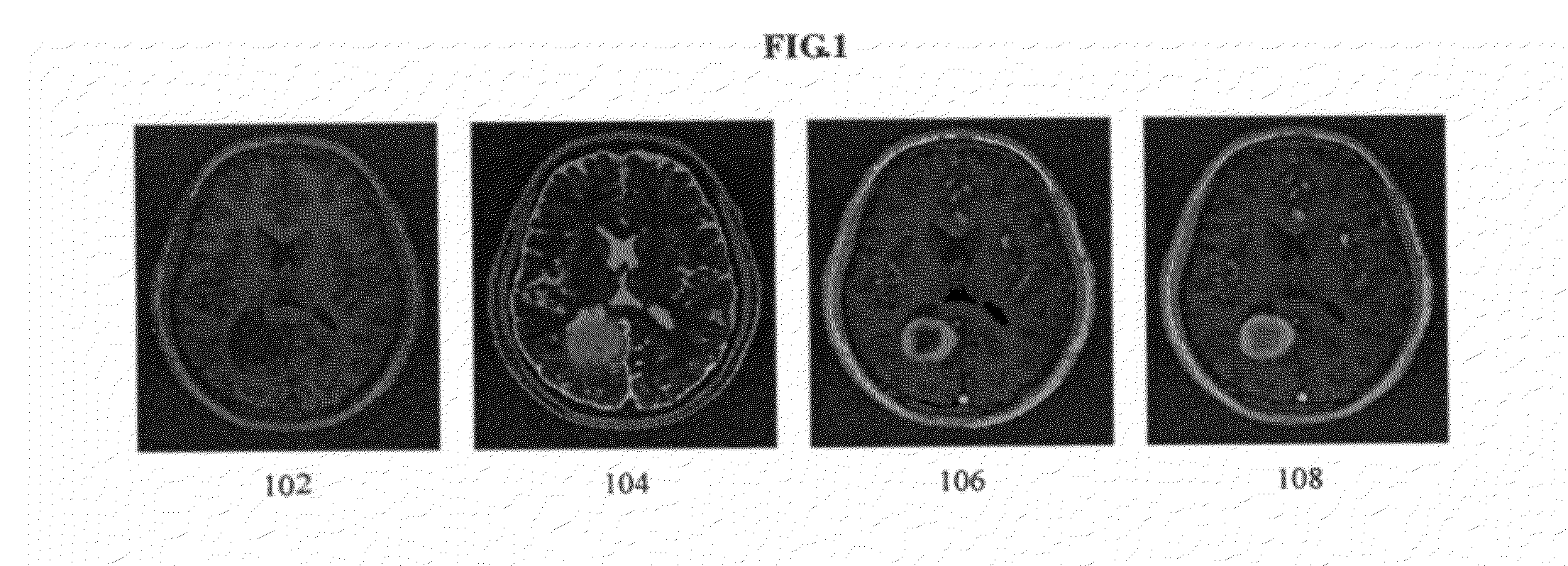 Method and system for brain tumor segmentation in multi-parameter 3D mr images via robust statistic information propagation