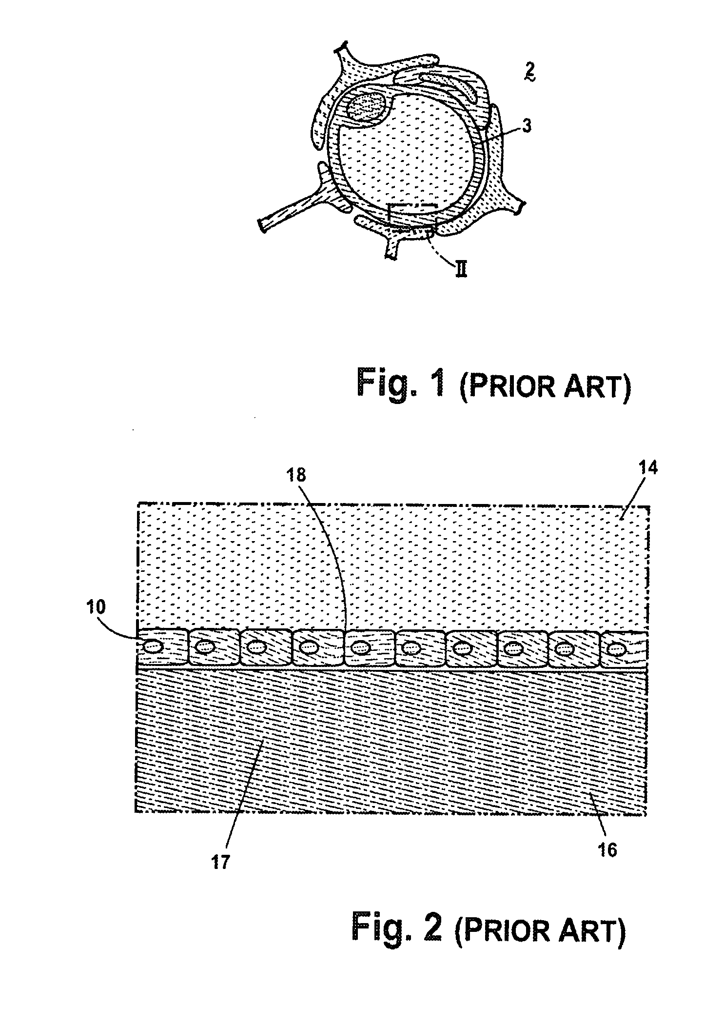 Composition and methods of treatment of bacterial meningitis