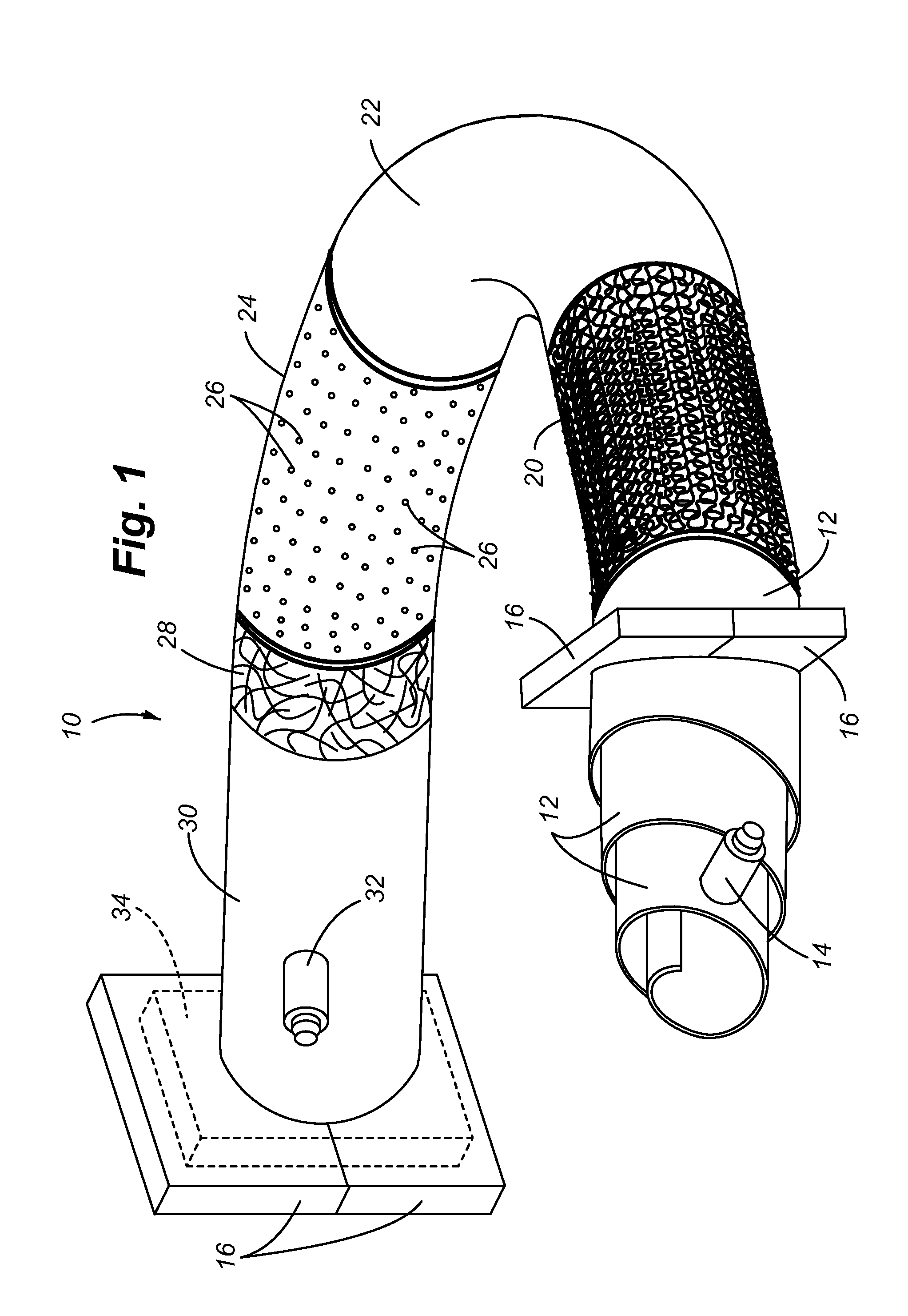 RFID and product labelling integrated in knit composite tubes for fluid delivery system