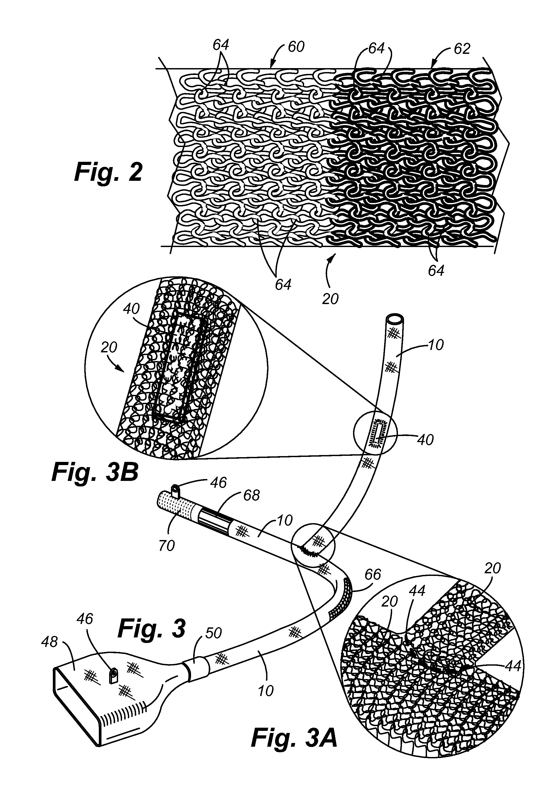 RFID and product labelling integrated in knit composite tubes for fluid delivery system