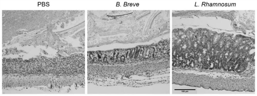 Use of microorganisms in the treatment and/or prevention of immune-mediated intestinal diseases