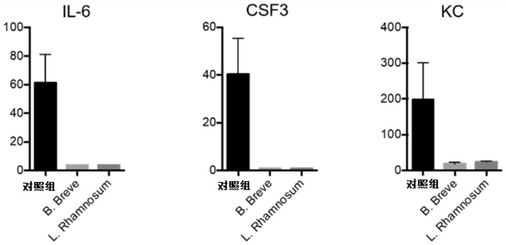 Use of microorganisms in the treatment and/or prevention of immune-mediated intestinal diseases