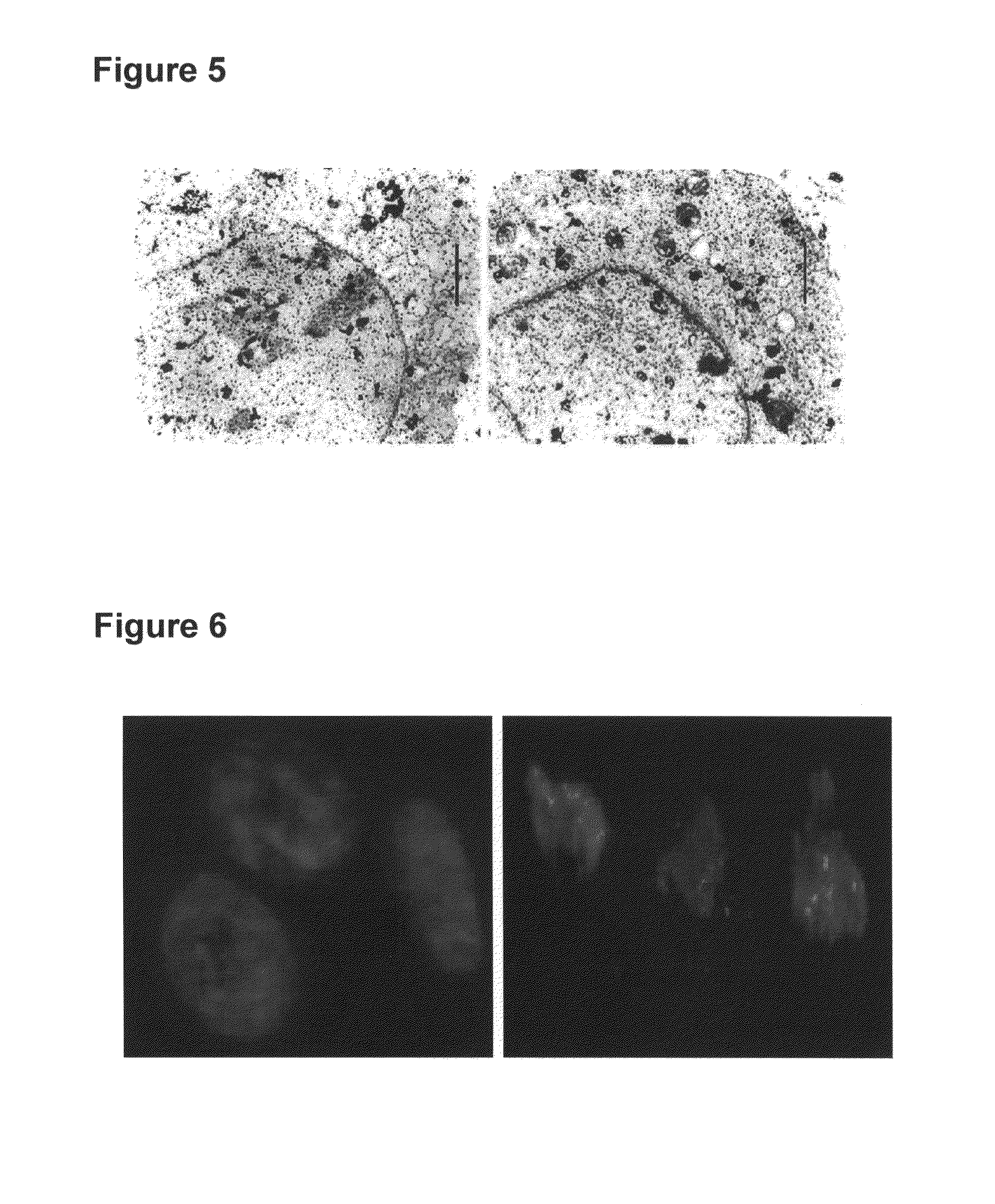 Method for ex-vivo separation of apoptotic chromatin fragments from blood or plasma for prevention and treatment of diverse human diseases