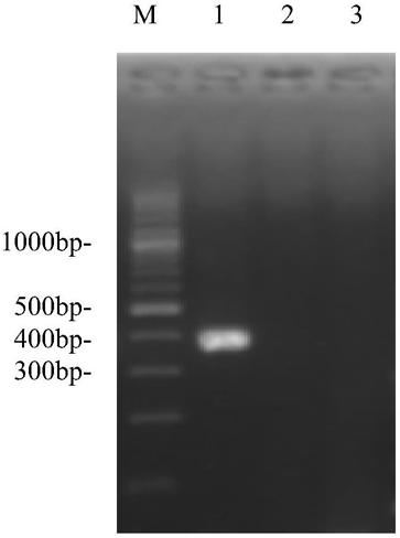 A primer pair for preparing and detecting avian adenovirus type 4 kit and its application