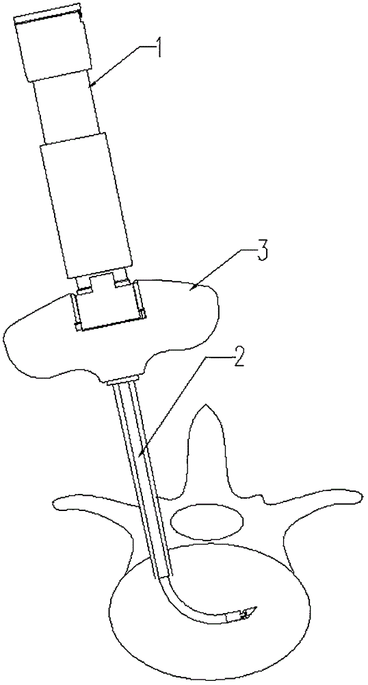 Cavity opening instrument