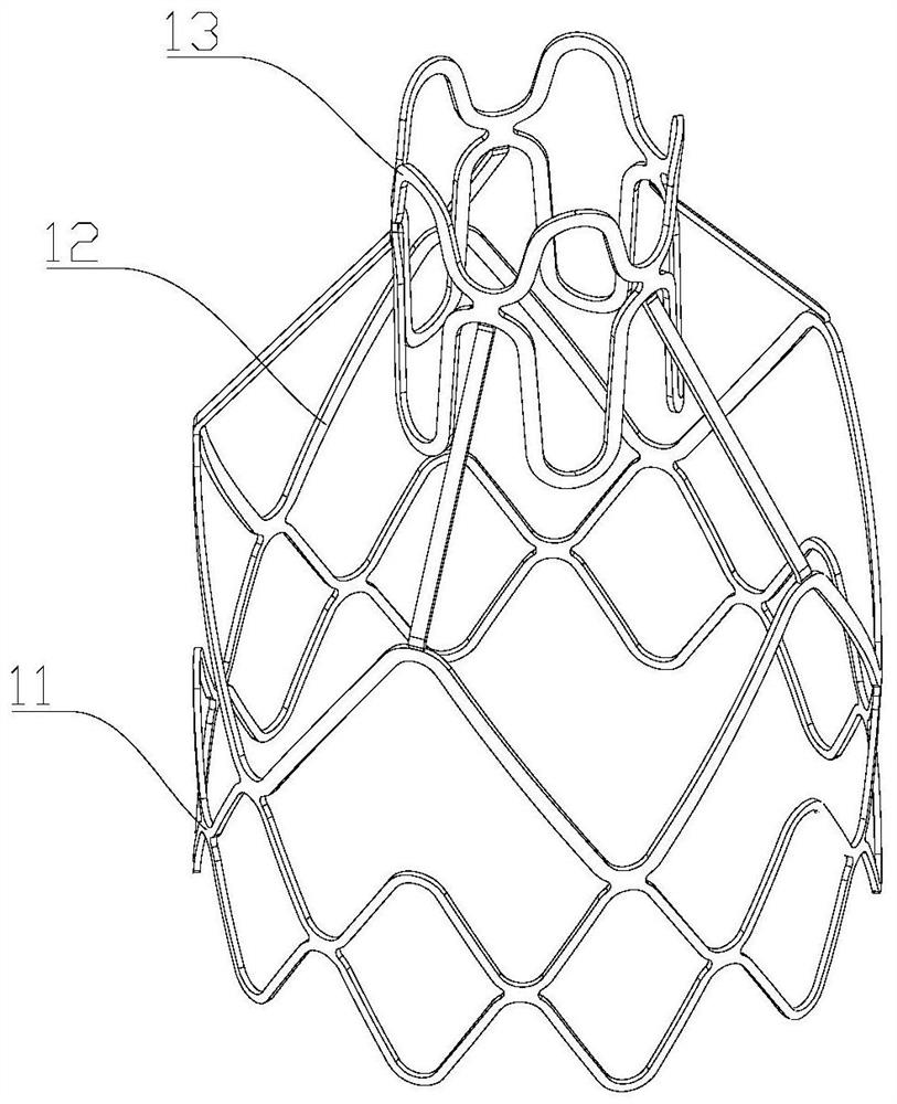 Bronchus one-way valve stent