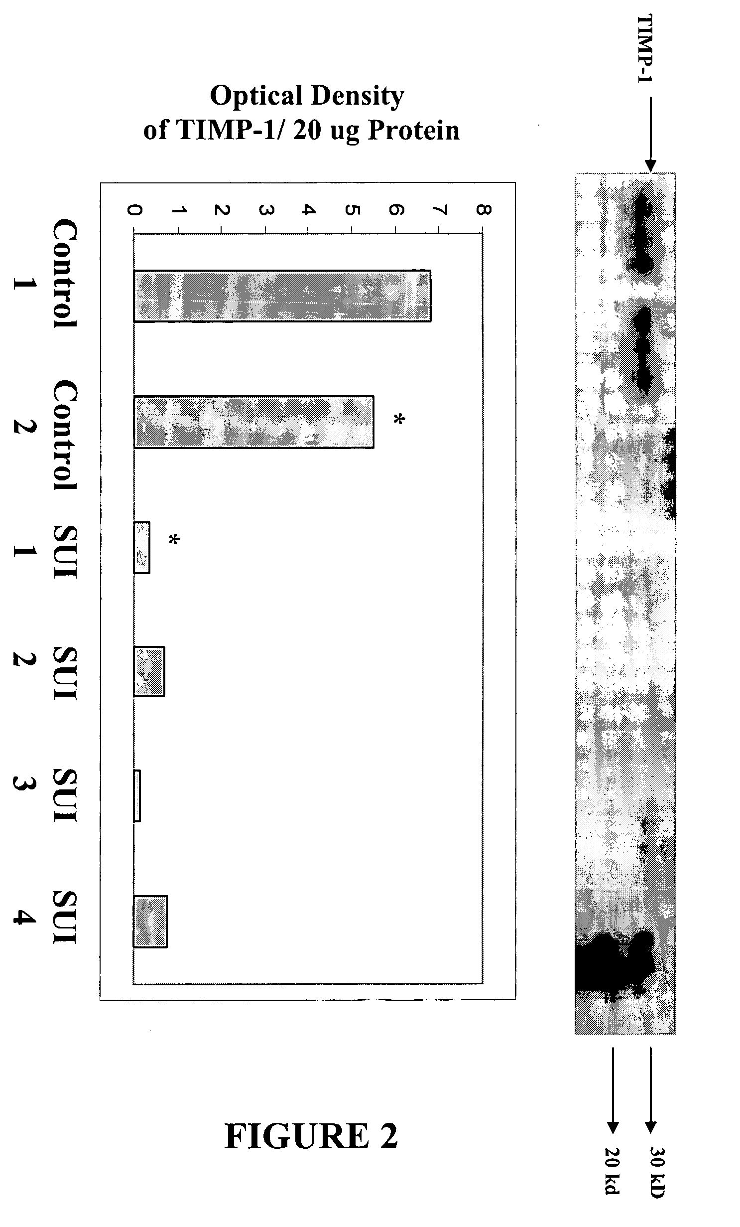 Diagnosis and treatment of disorders of collagen and elastin metabolism